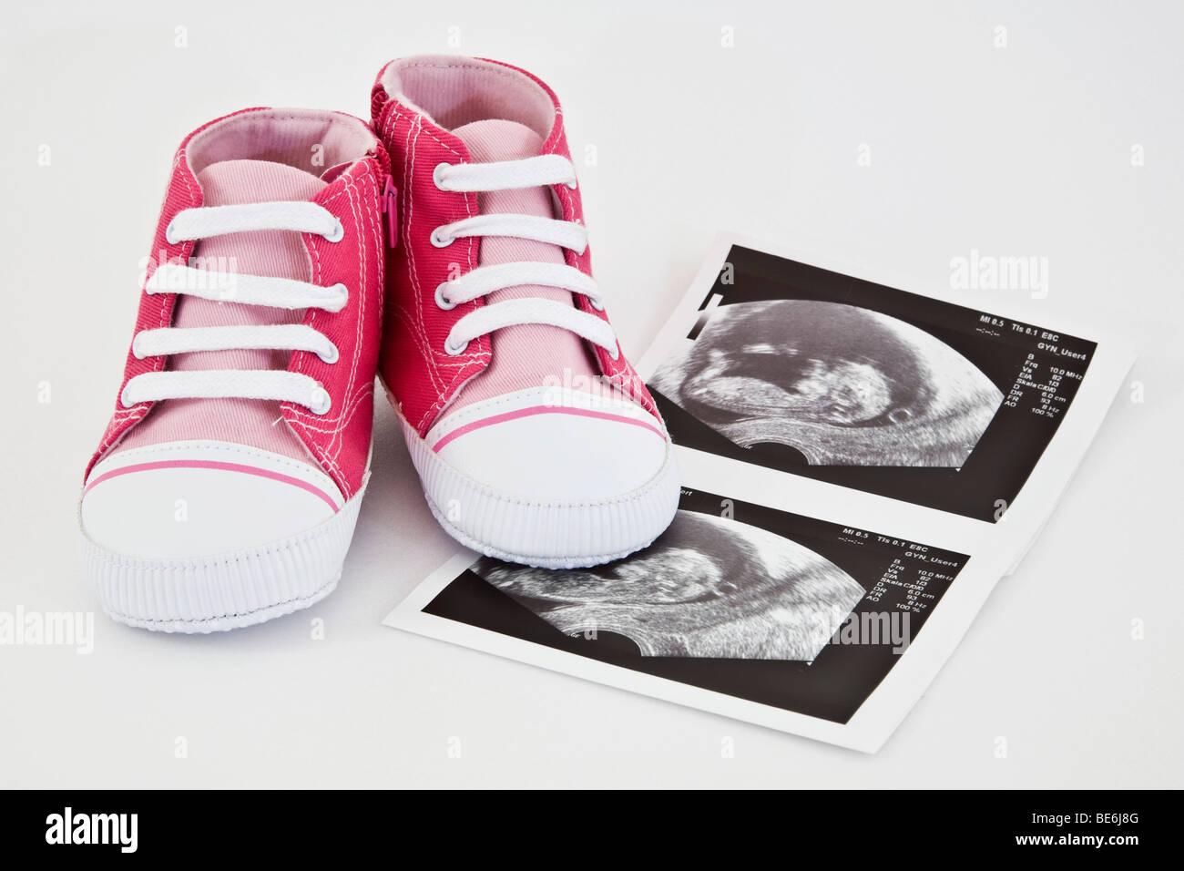 Scarpe per bambini con ultrasonograms Foto Stock