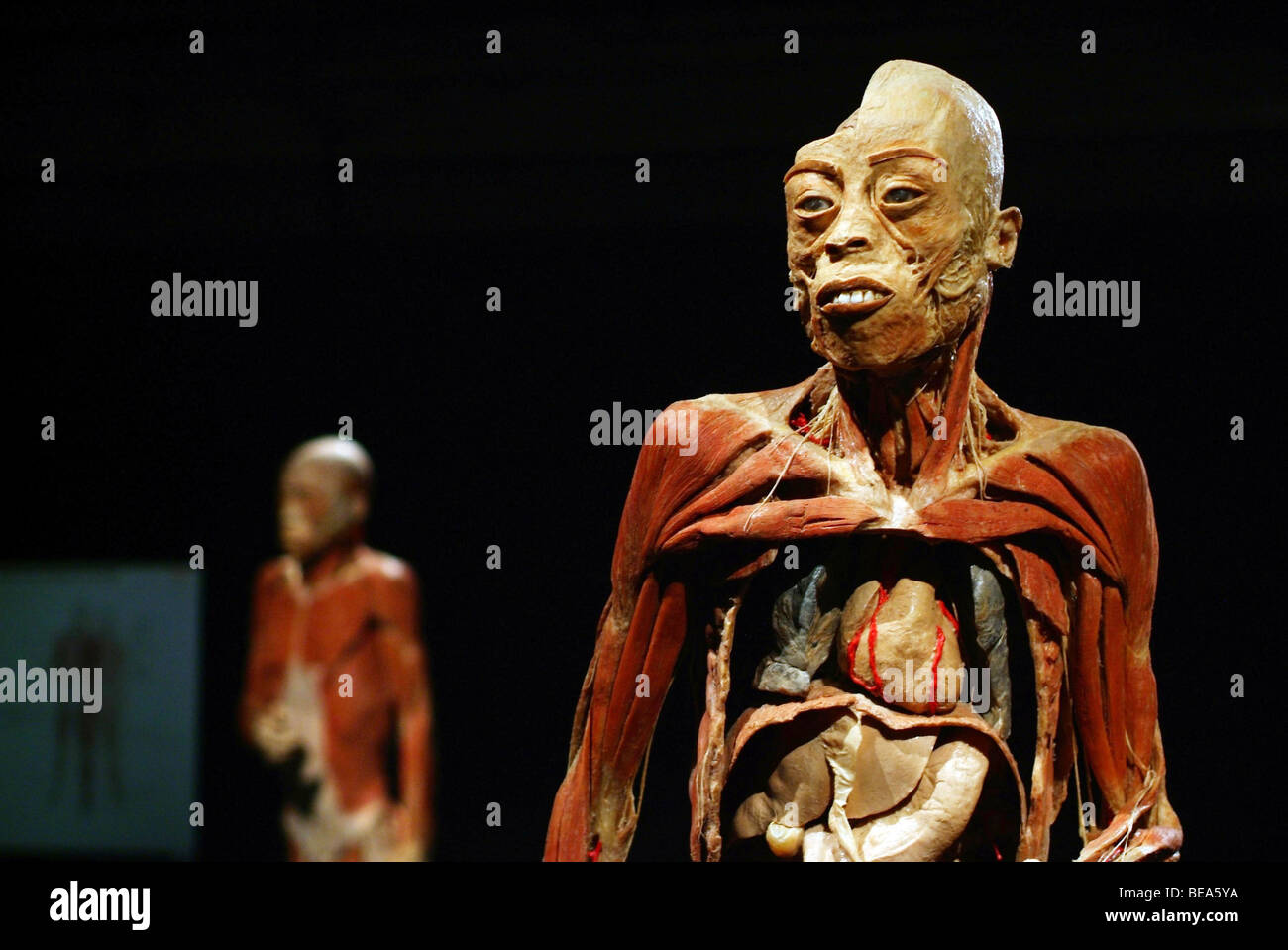 Lione (69): mostra 'il nostro corpo / à Corps Ouvert" (2008-05-27) Foto Stock