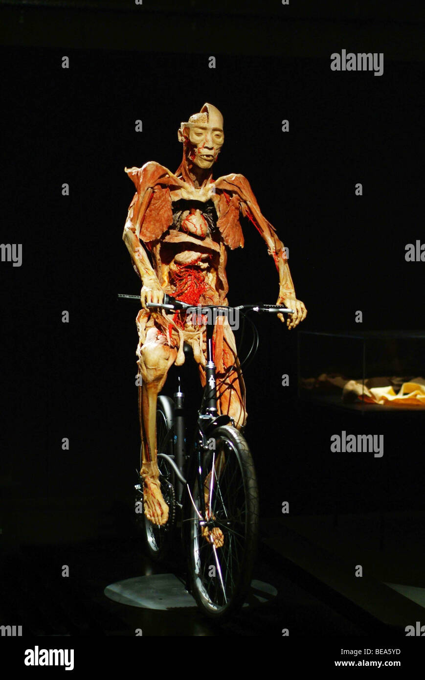 Lione (69): mostra 'il nostro corpo / à Corps Ouvert" (2008-05-27) Foto Stock
