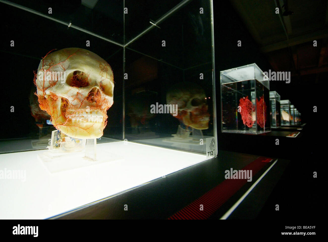 Lione (69): mostra 'il nostro corpo / à Corps Ouvert" (2008-05-27) Foto Stock