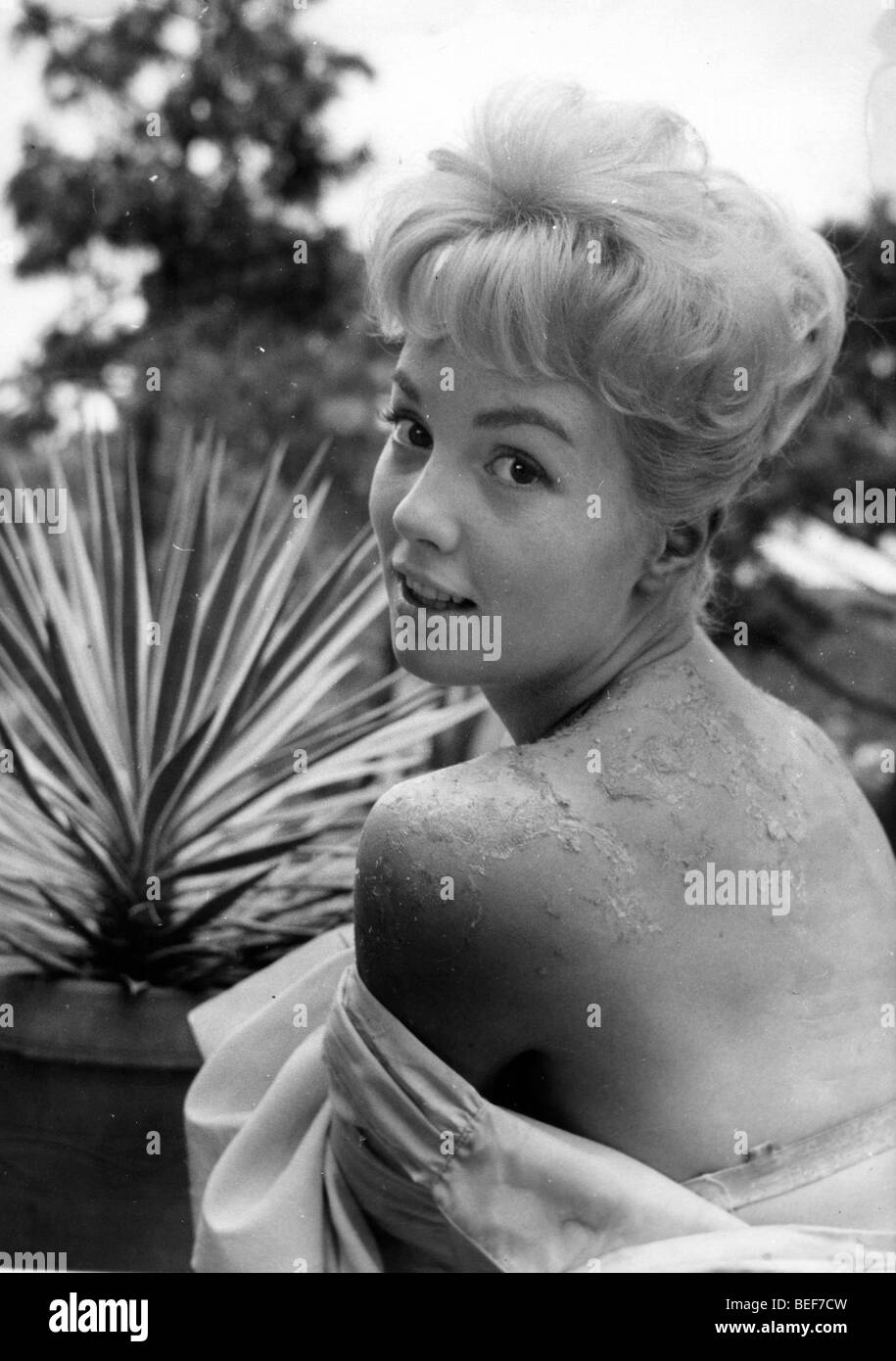 L'attrice Sandra Dee mostra off peeling pelle sulla sua schiena circa 1959. Foto Stock