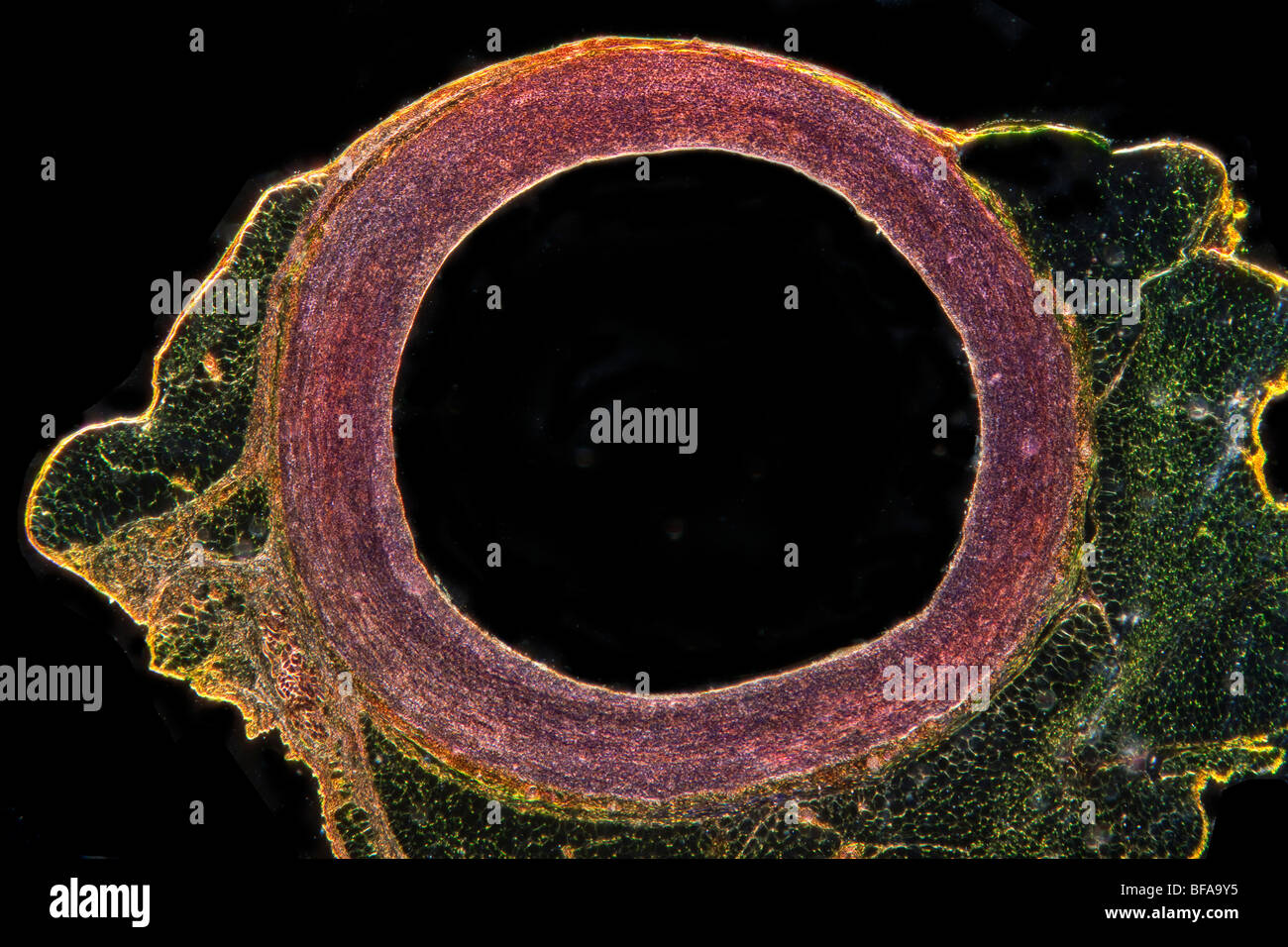 Aorta sezione TS in cat Foto Stock