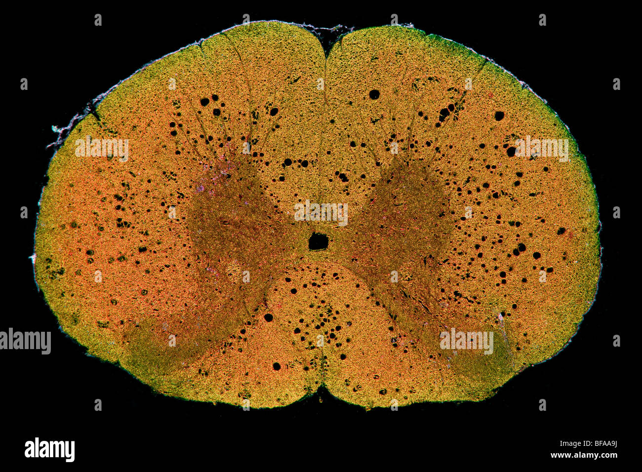 Campo oscuro fotomicrografia mammifero il midollo spinale TS Foto Stock