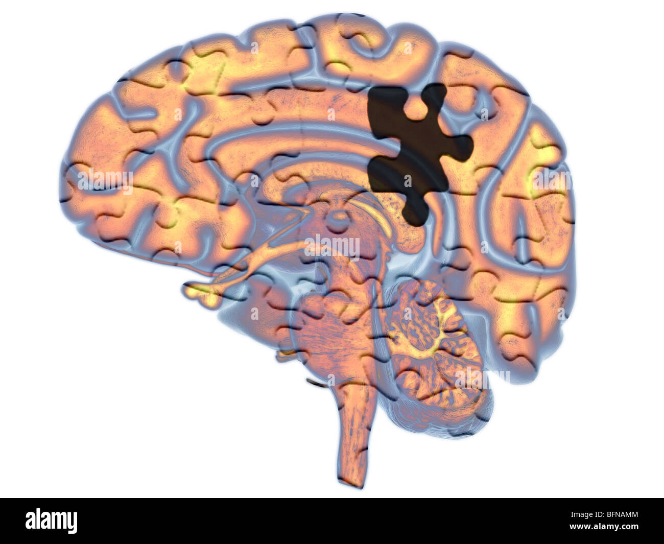 Illustrazione del cervello umano è raffigurato come un puzzle o mistero Foto Stock