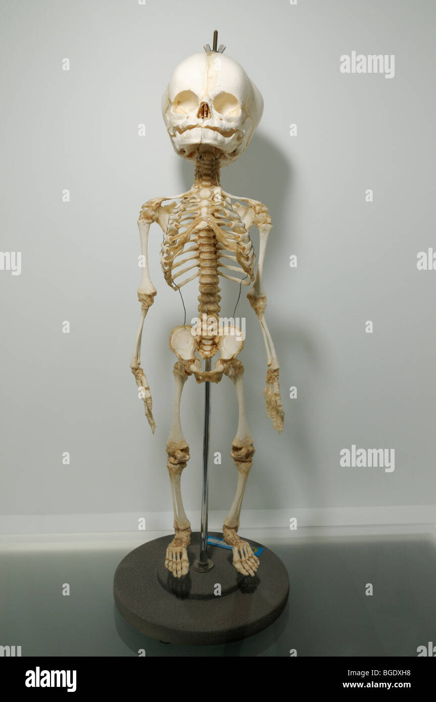 Lo scheletro di un feto umano Foto Stock