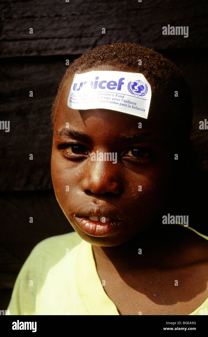 Orfanotrofio di Ndosho, Goma, Agosto 1994. Un ragazzo ha un adesivo di UNICEF sulla sua fronte. Foto Stock