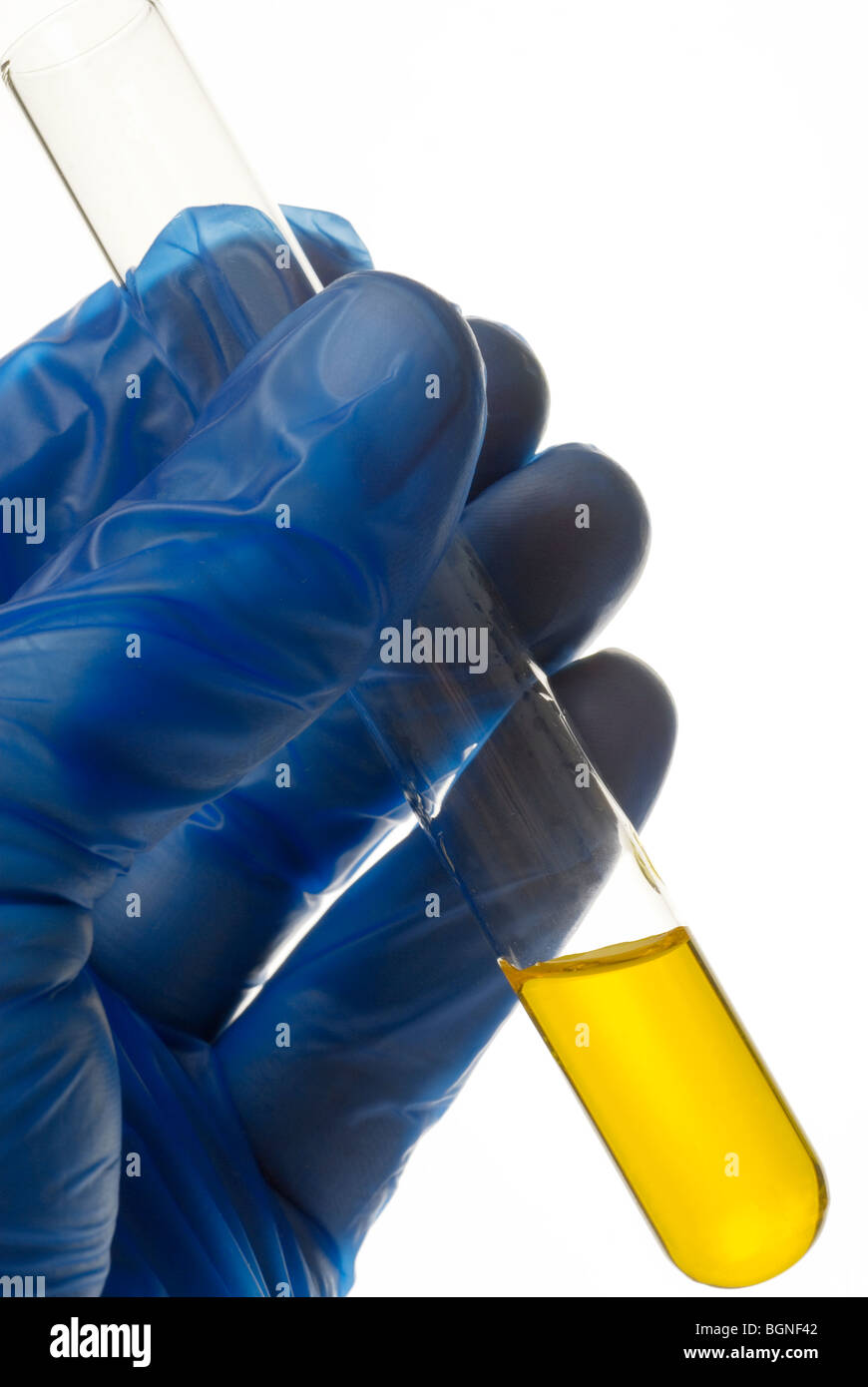Blue mano guantata holding provetta con il campione di colore giallo Foto Stock