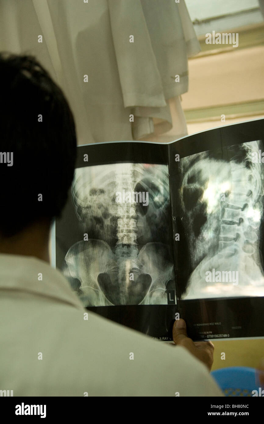 Cicr eseguire Ospedale ortopedico di Kabul guardando da lesioni del midollo spinale Foto Stock