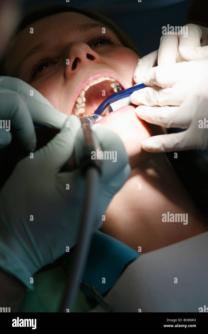 Close-up di un dentista e un assistente dentale lavorando su un paziente femmina Foto Stock