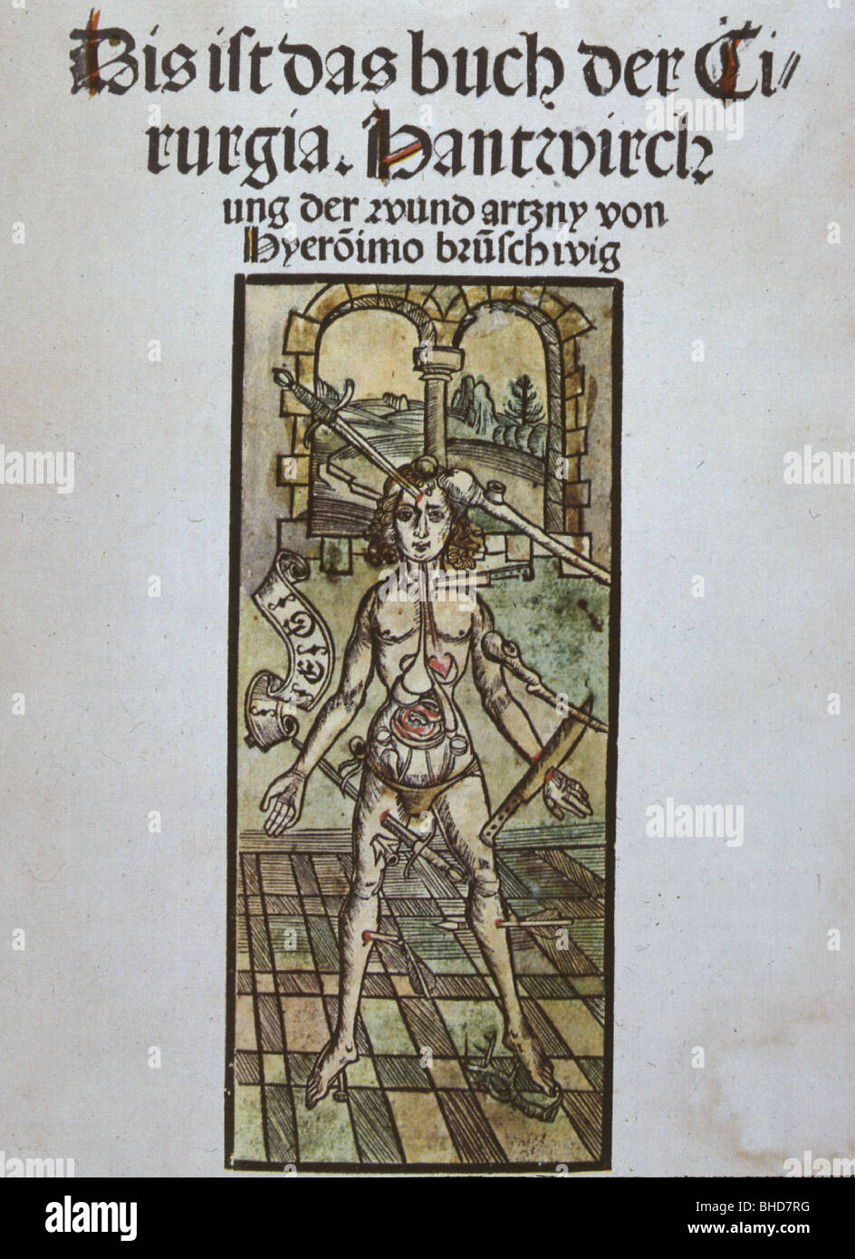 Medicina, Hyronimus Bruschwig (Hieronymus Brunschwig), Manuale Di Chirurgia, Strasburgo, Germania, 1497, Foto Stock