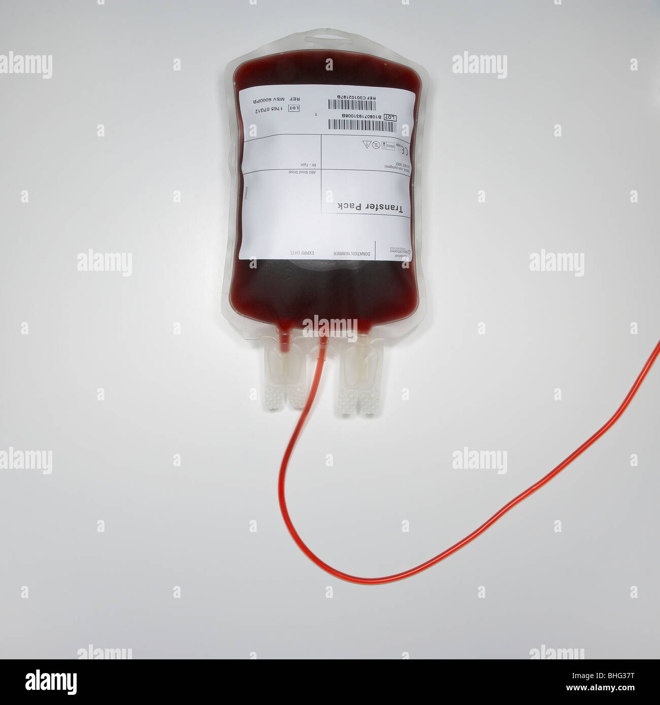 Sacca di sangue, donatore, trapianto, ospedale, endovenosa, emergenza, tubi, cellule, mediche, trattamento, NHS Foto Stock