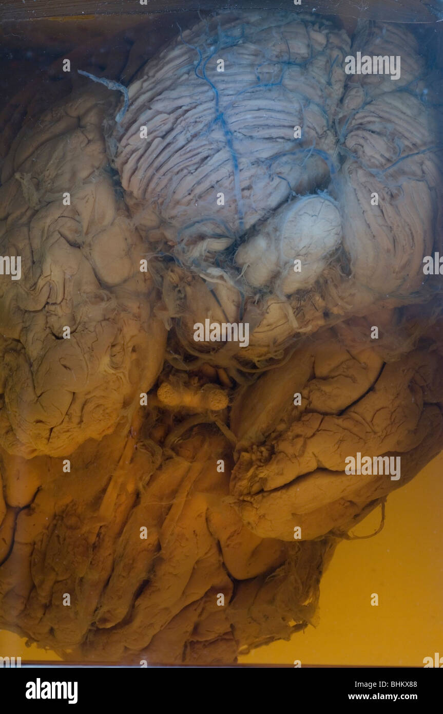 Cervello umano imbalsamato in un vasetto di vetro Foto Stock