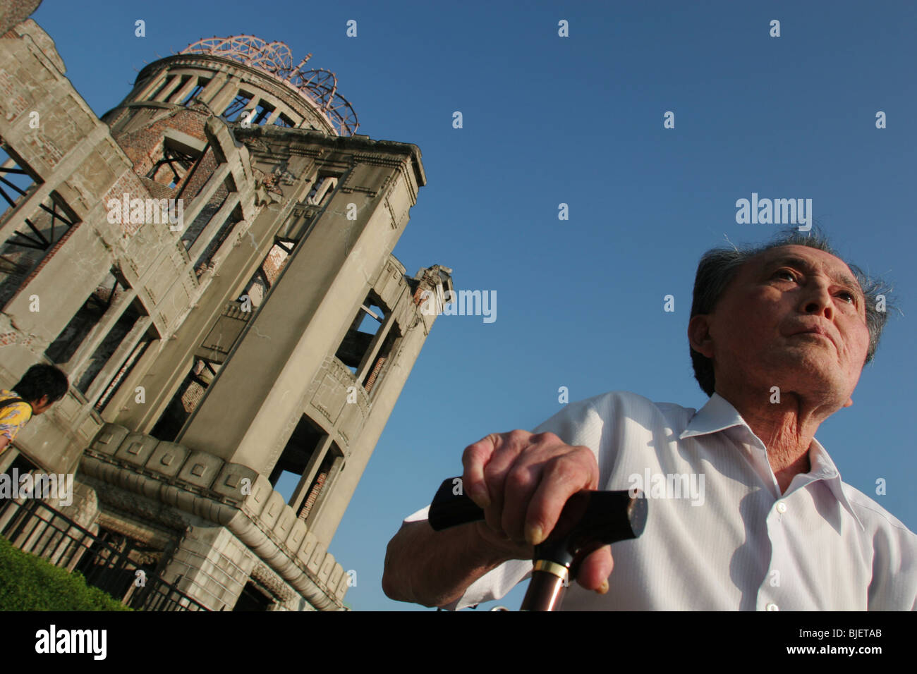 Seiko Komatsu, 69 anni, feriti della bomba atomica blast del 6 agosto 1945 a Hiroshima, Giappone. Foto Stock