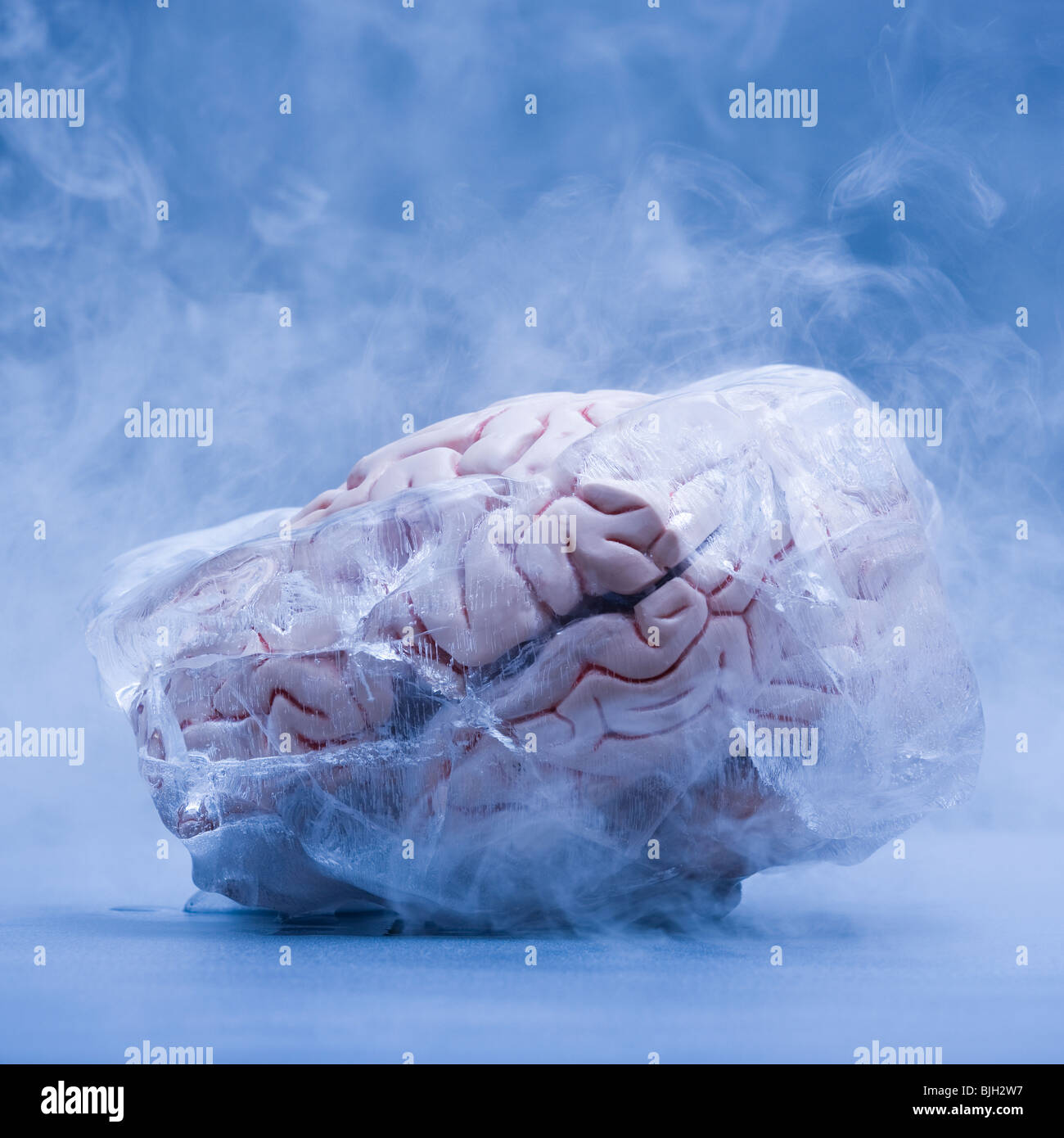 congelare il cervello Foto stock - Alamy