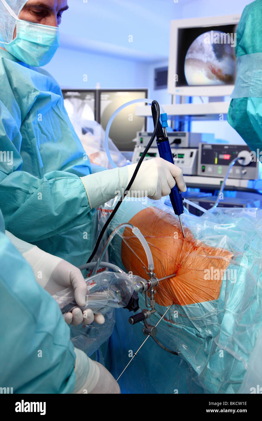 Ospedale, intervento chirurgico camera, la chirurgia artroscopica di un'anca. Foto Stock