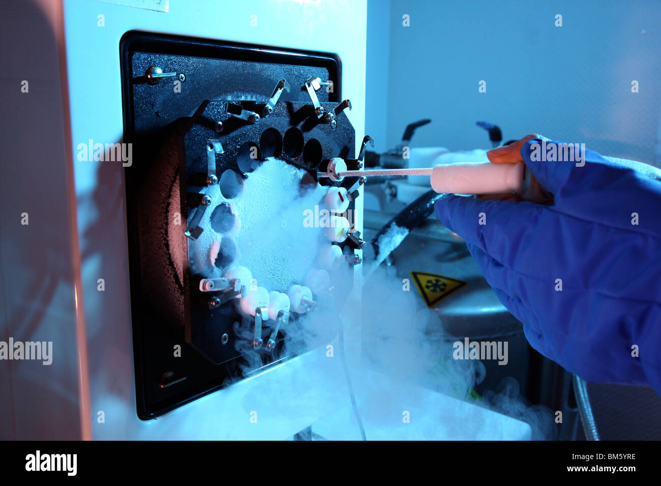 Clinica per la fecondazione in vitro. La fecondazione artificiale. Lo sperma è iniettato in un uovo. Lo sperma è conservata in azoto liquido. Foto Stock