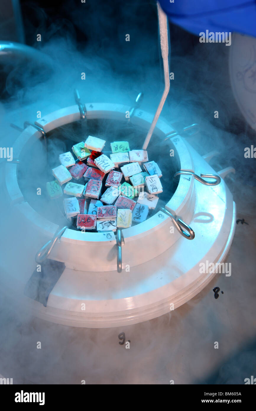 Clinica per la fecondazione in vitro. La fecondazione artificiale. Lo sperma è iniettato in un uovo. Lo sperma è conservata in azoto liquido. Foto Stock