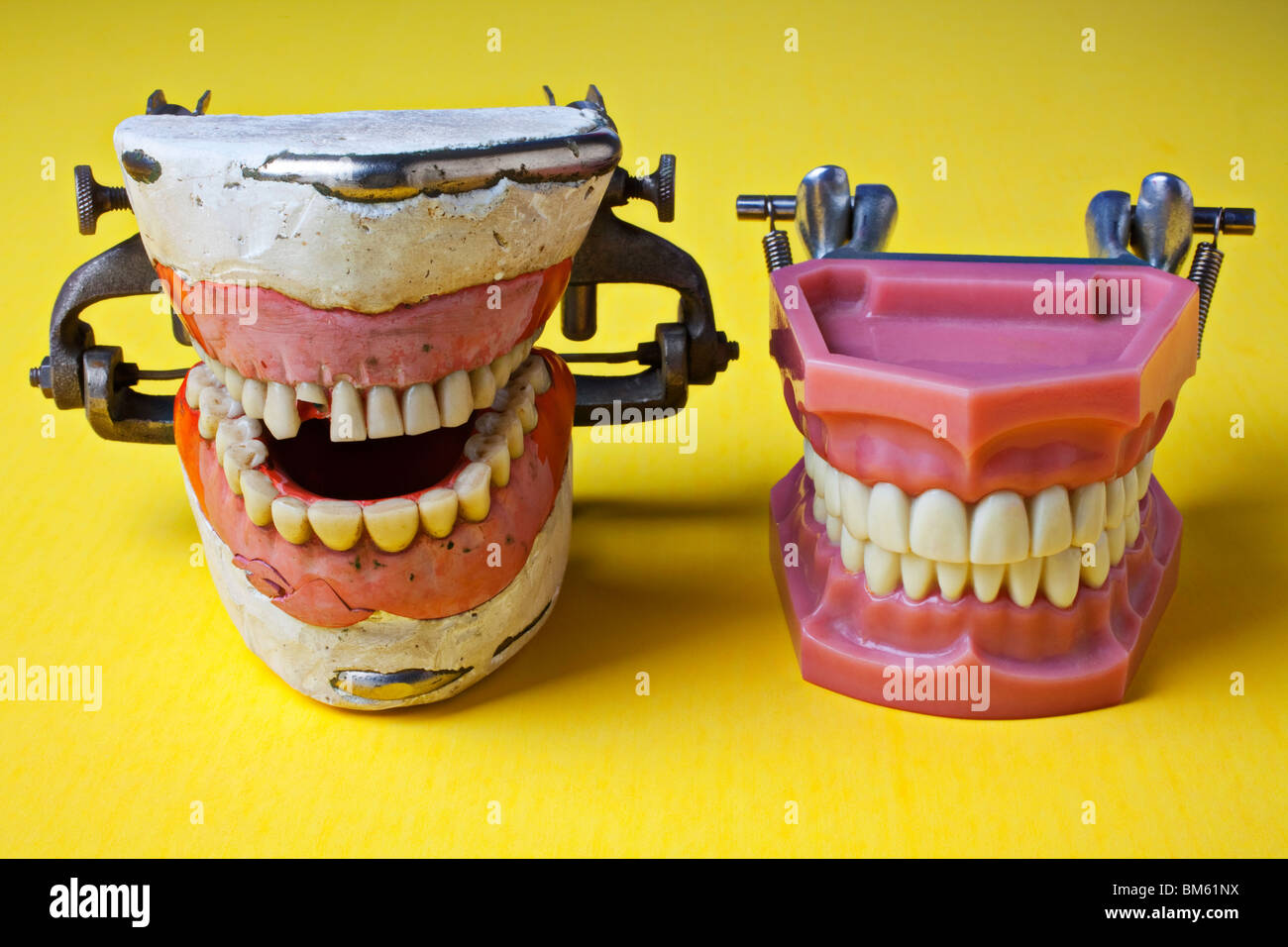 Modelli dentali, cattivo denti, buona denti Foto Stock