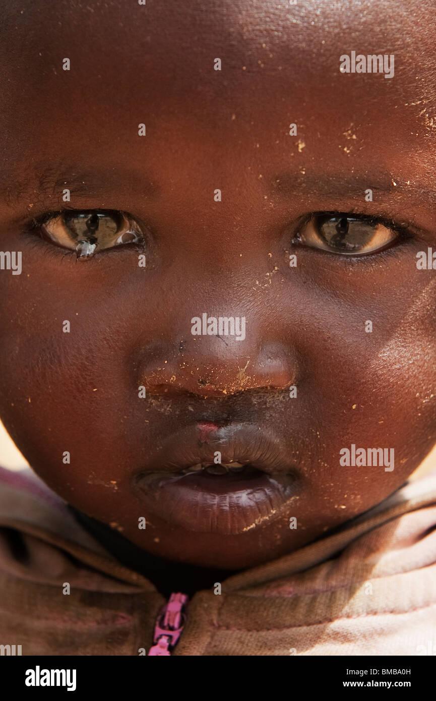 I bambini sono tra quelli che risentono di più a causa della mancanza di cibo e di acqua. "Elsie' è 4 anni. Foto Stock