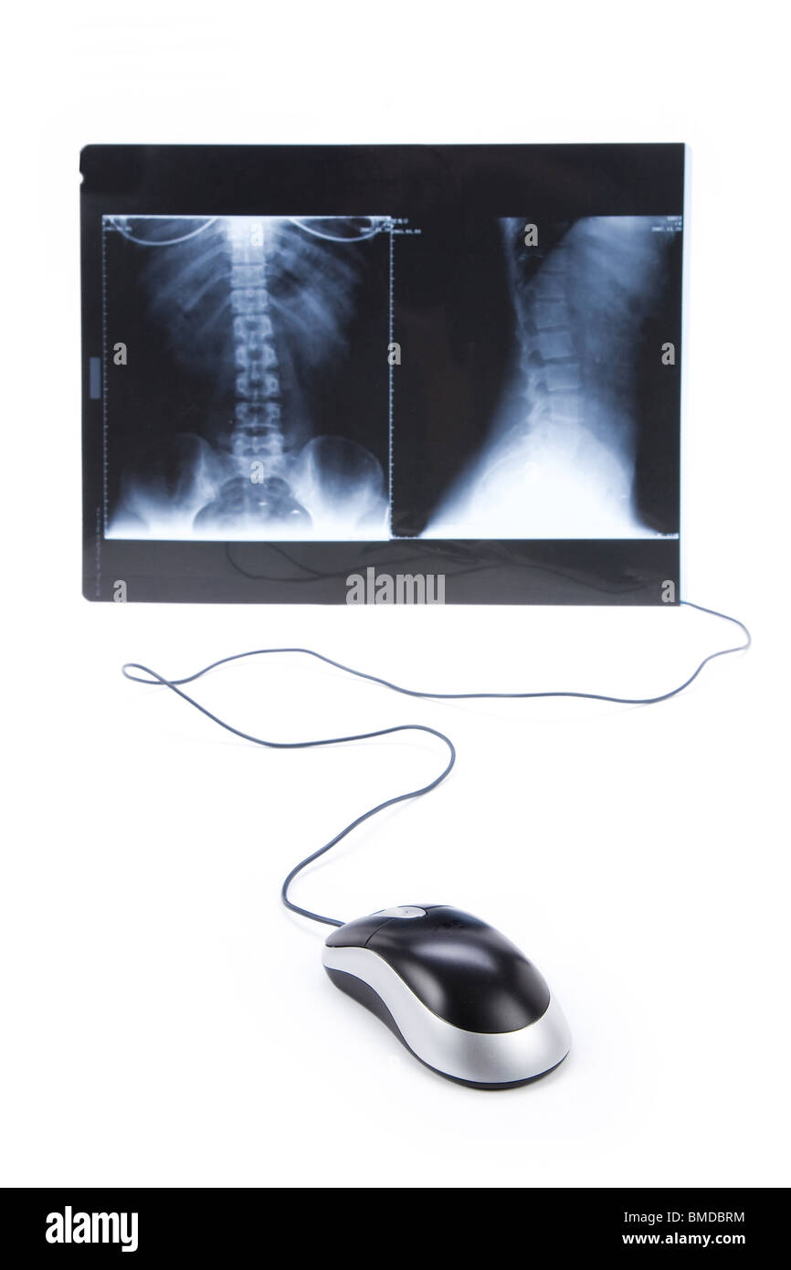 Immagine a raggi x e il mouse del computer, di un concetto moderno di diagnosi mediche Foto Stock Immagine a raggi x e il mouse del computer, di un concetto moderno di diagnosi mediche Foto Stock