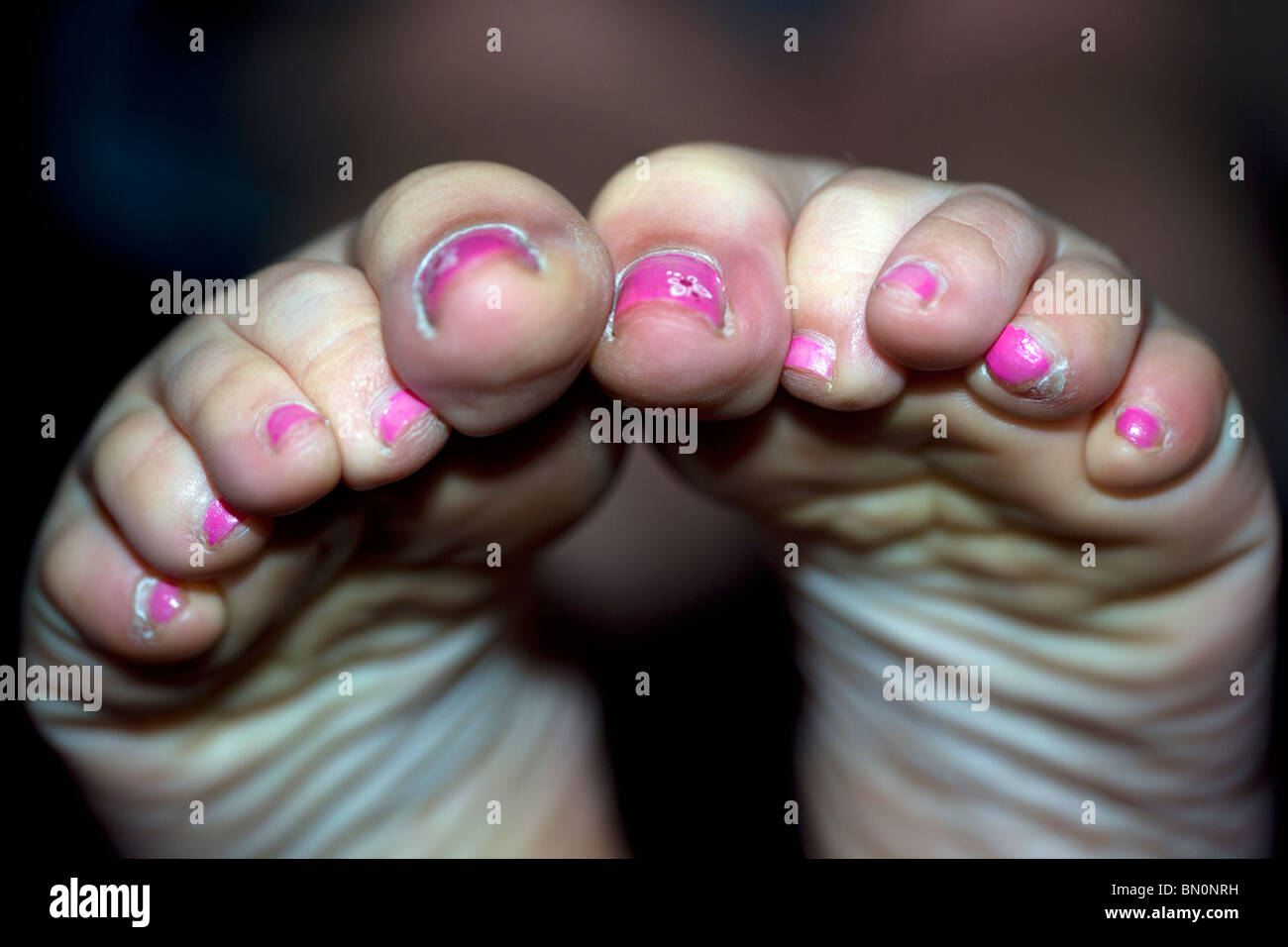 Close up di un signore piedi con unghie verniciate, stropicciata suole, punte arricciate Foto Stock