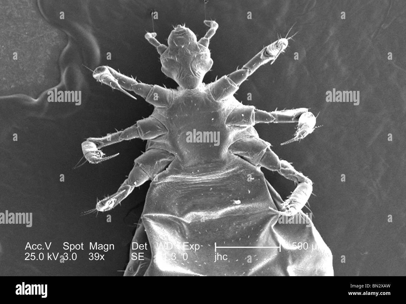Scanning Electron (micrografica SEM) di un corpo femminile pidocchio Pediculus humanus corporis var. da una prospettiva ventrale. Foto Stock