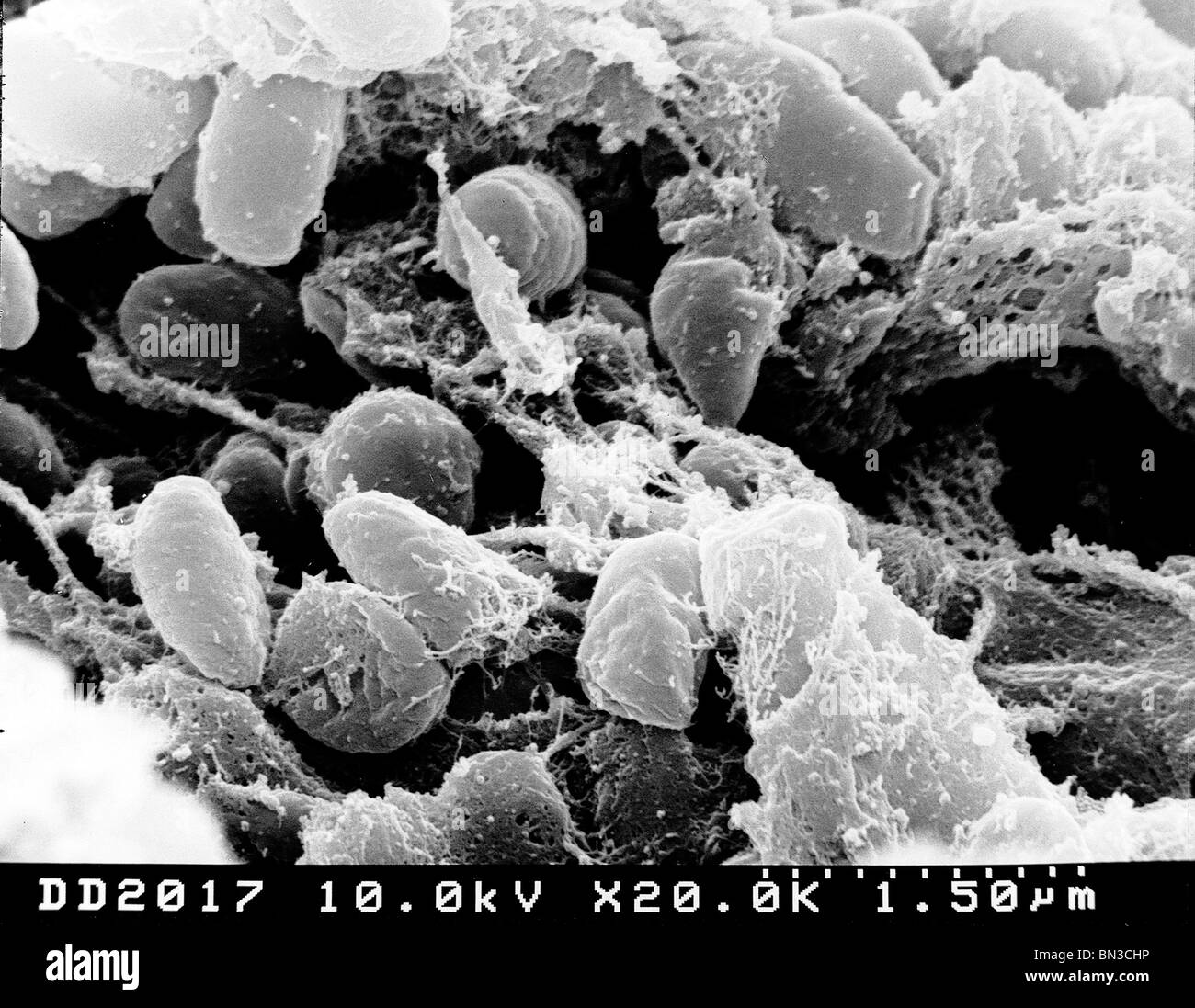 Scanning electron microfotografia raffigurante una massa di Yersinia pestis batteri (la causa della peste bubbonica) Foto Stock