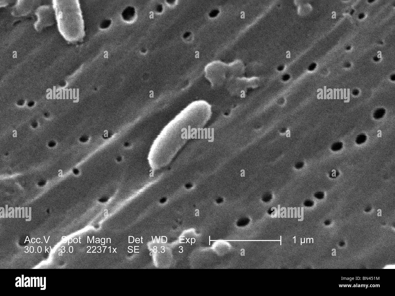 Micrografia al microscopio elettronico a scansione (SEM) di Vibrio cholerae batteri del sierogruppo 01; magnificato 22371x Foto Stock