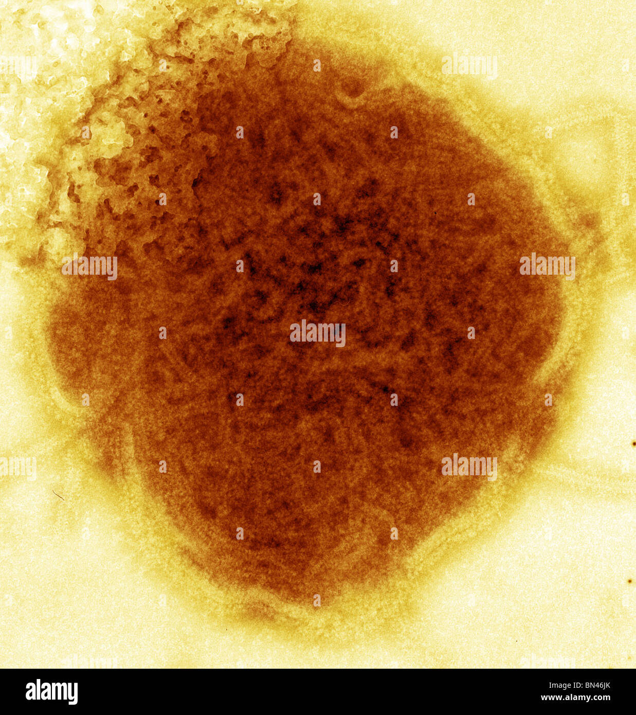 Colorate negativo microscopio elettronico a trasmissione (TEM) del virus della parotite Foto Stock