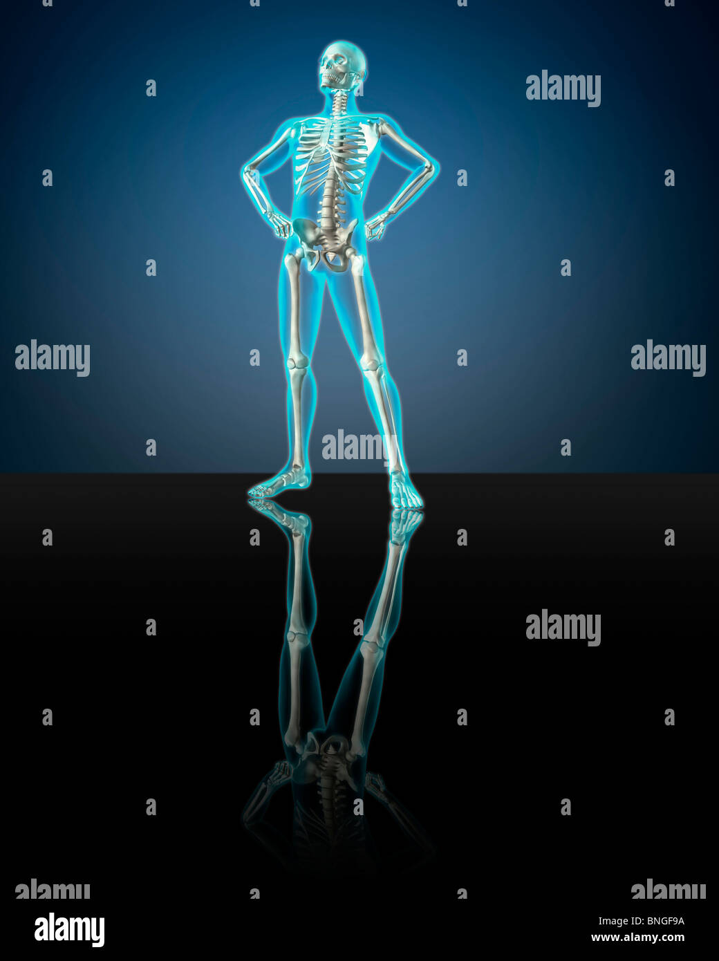 Vista ai raggi X di uno scheletro umano in posa Foto Stock