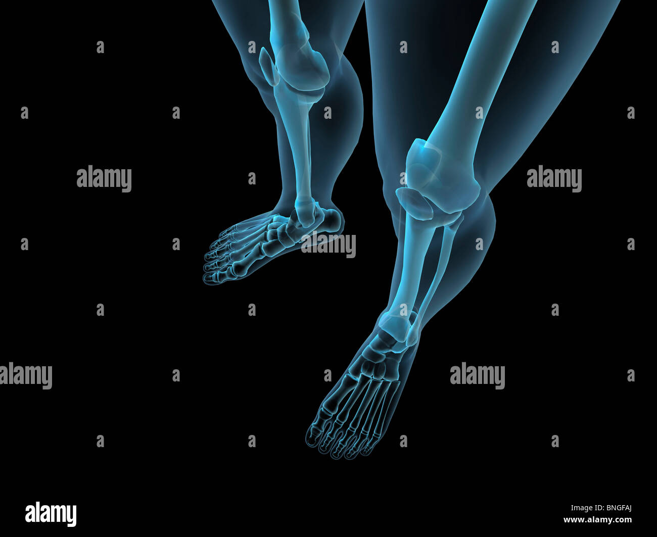 Vista a raggi X delle ginocchia Foto Stock