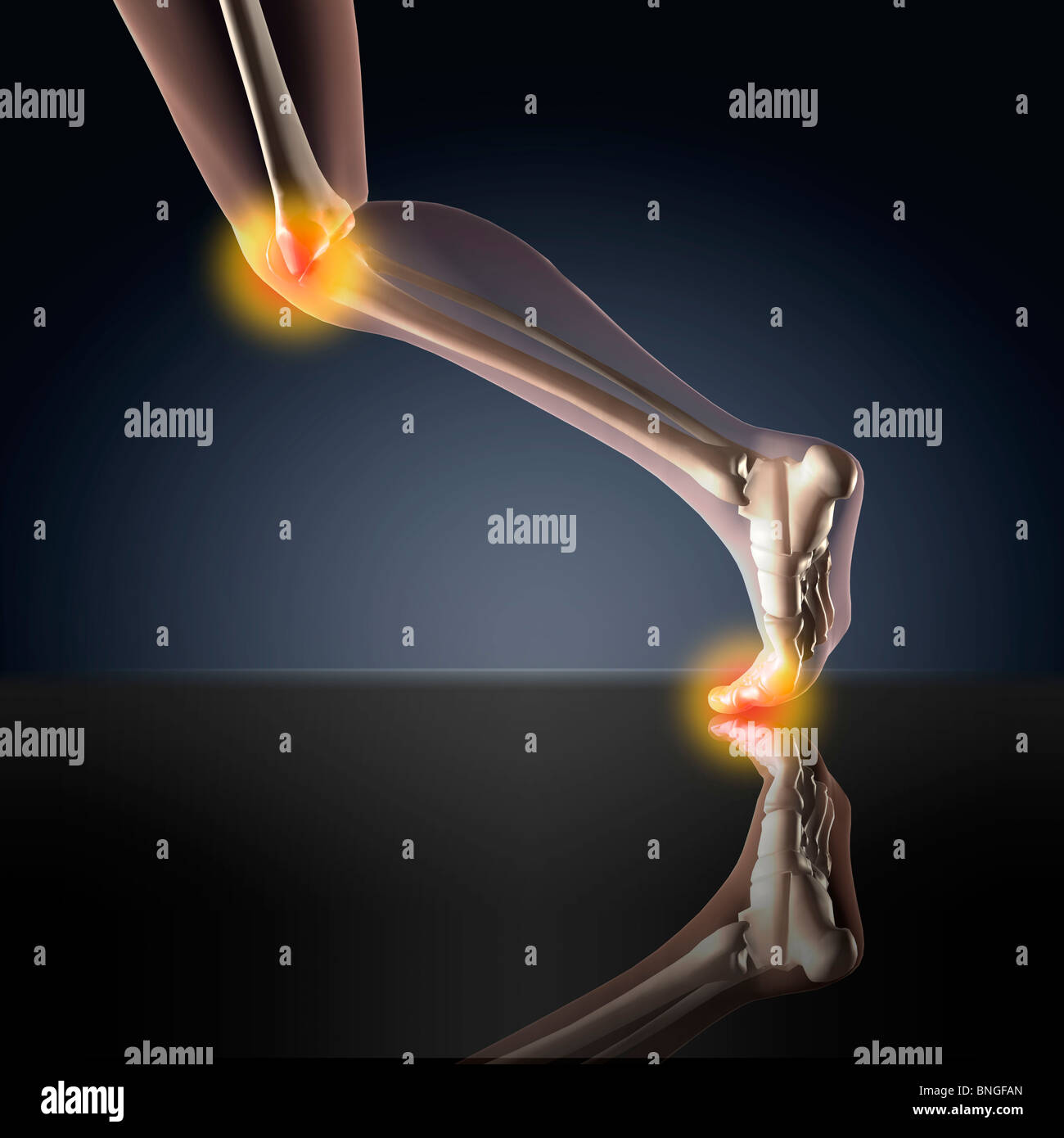 Vista ai raggi X di un essere umano è la gamba che mostra il dolore in ginocchio e caviglia in posizione di marcia Foto Stock