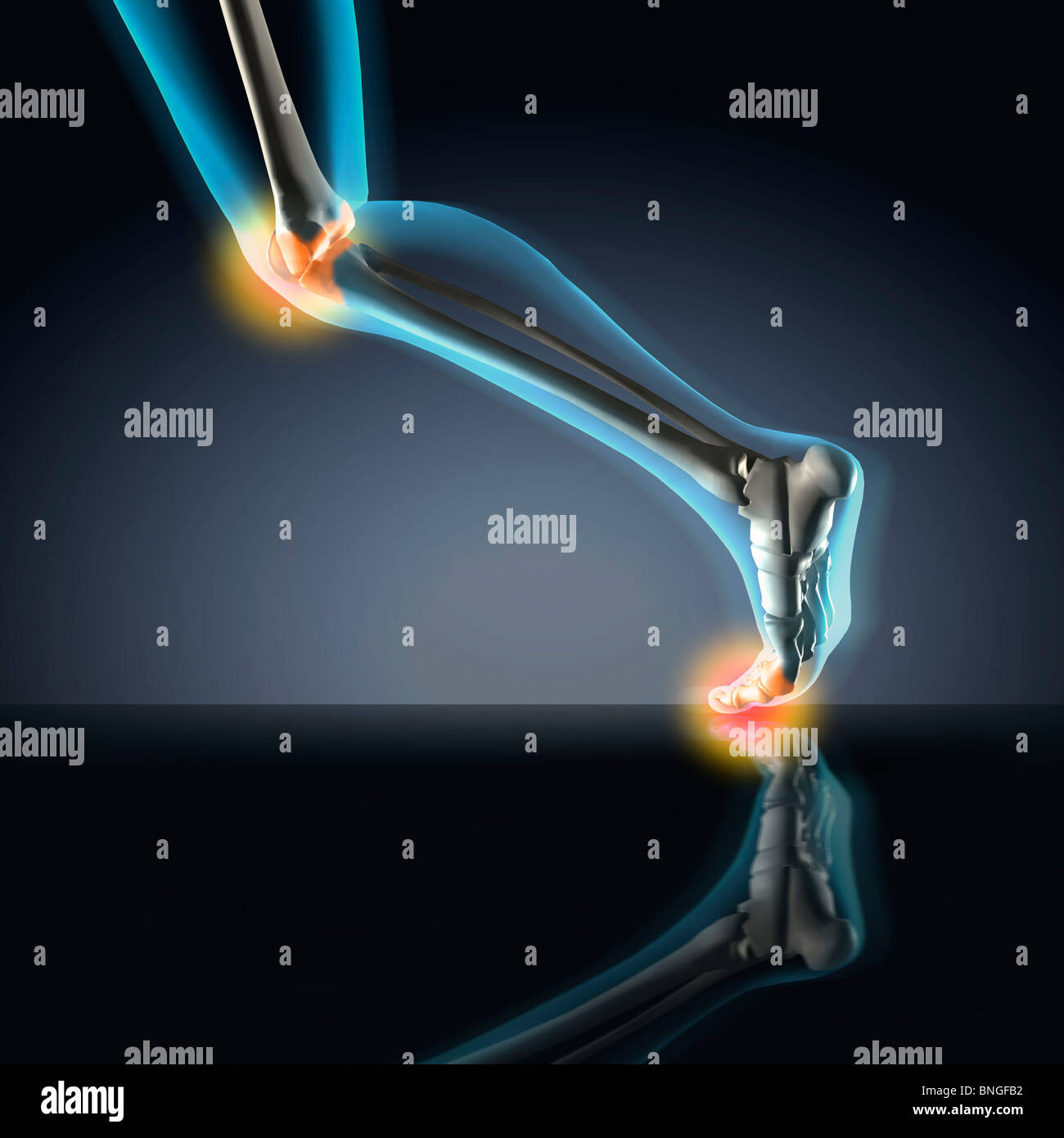 Vista ai raggi X di un essere umano è la gamba che mostra il dolore in ginocchio, caviglia e piede nella posizione di marcia Foto Stock