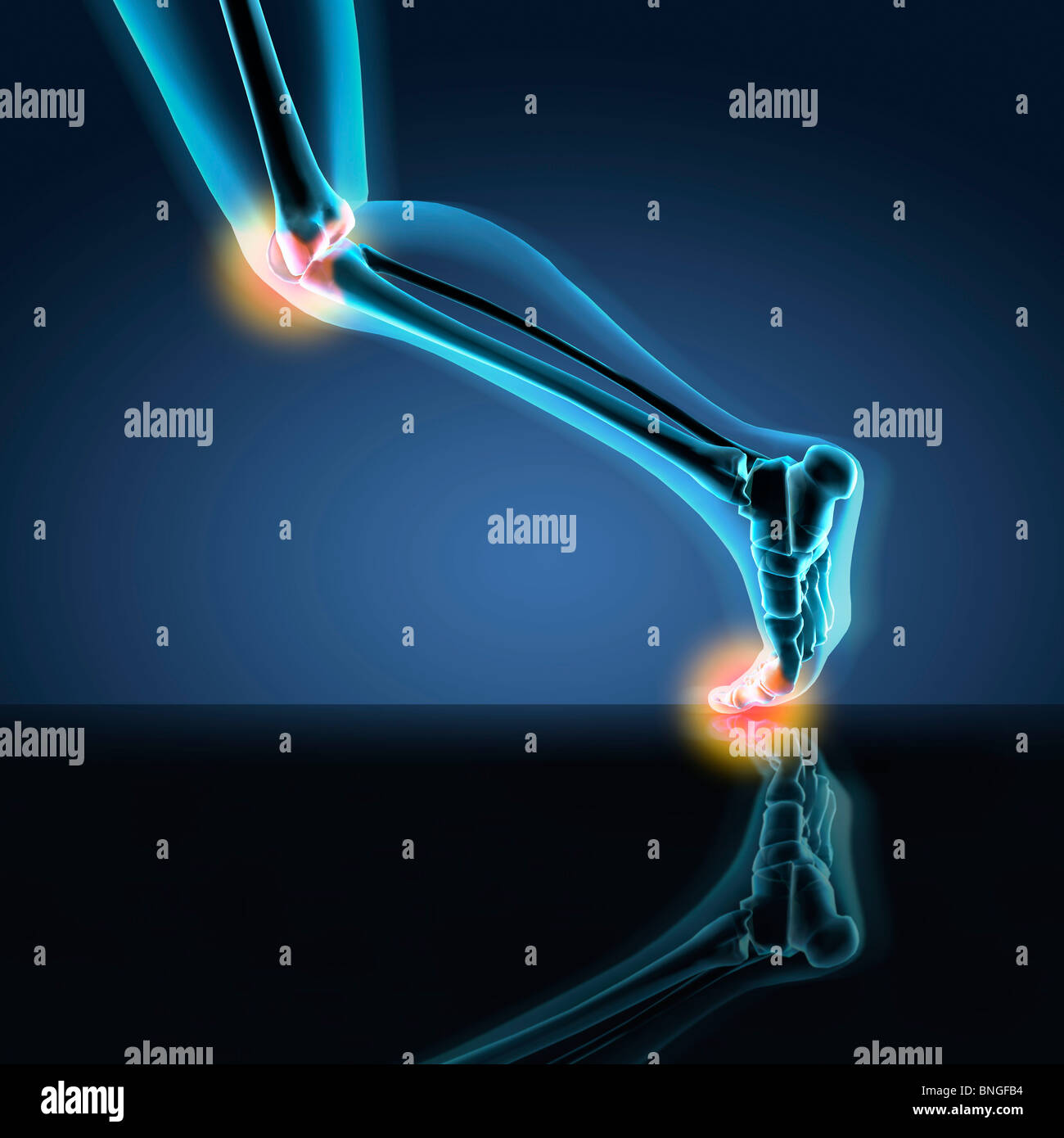 Vista ai raggi X di un essere umano è la gamba che mostra il dolore in ginocchio, caviglia e piede nella posizione di marcia Foto Stock