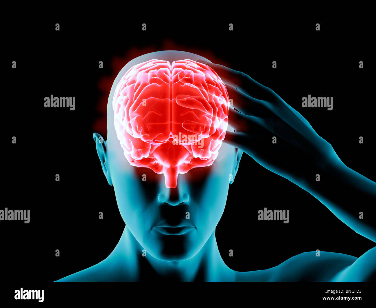 Vista ai raggi X di un uomo afferrando la sua testa nel dolore Foto Stock