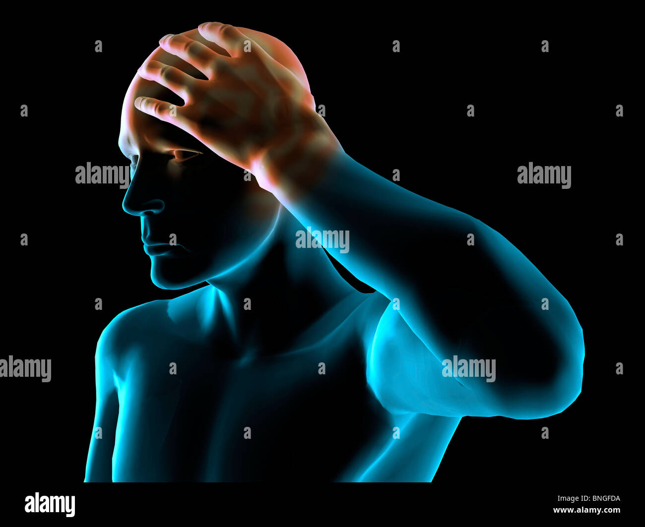 Vista ai raggi X di un uomo afferrando la sua testa nel dolore Foto Stock