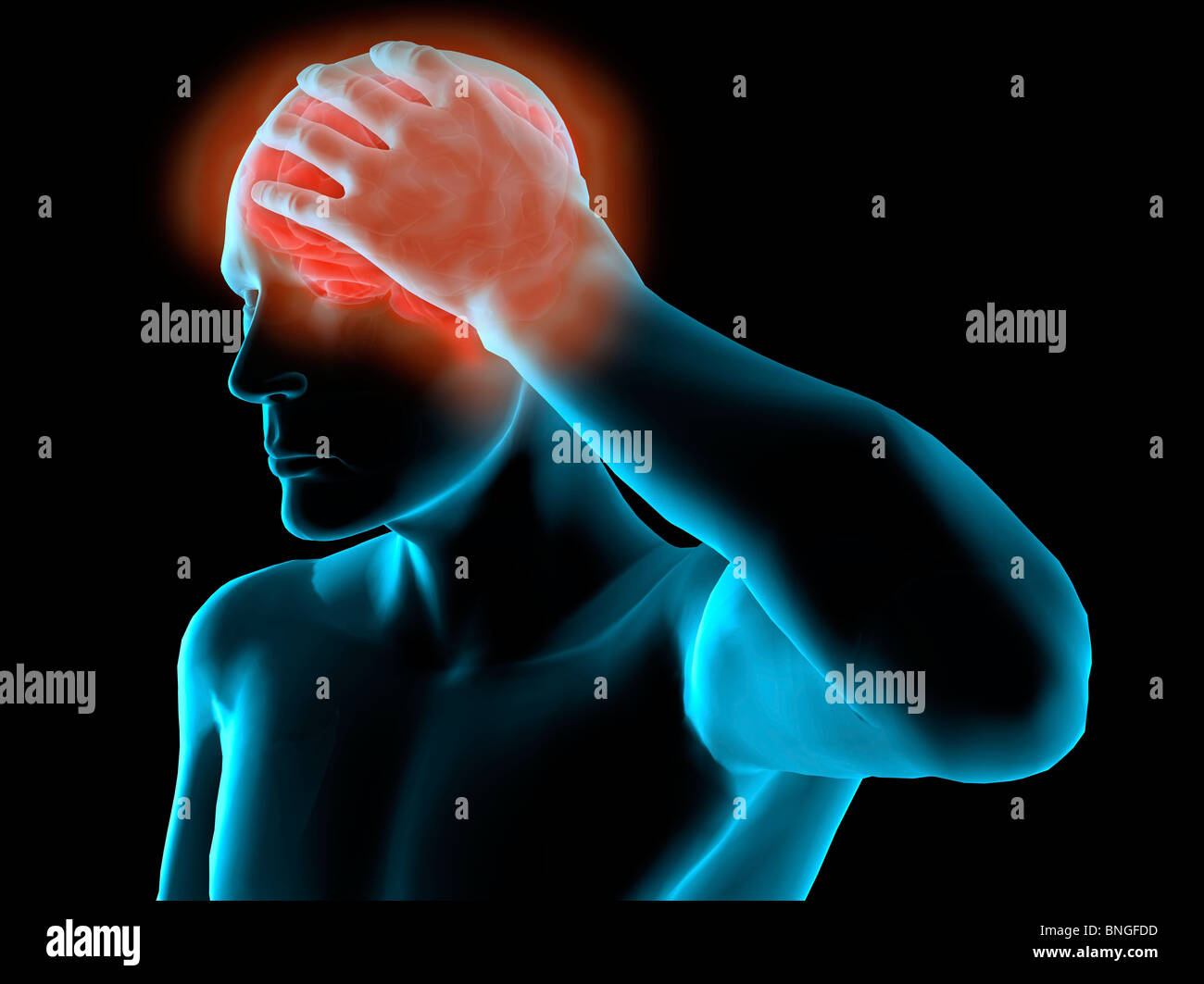 Vista ai raggi X di un uomo afferrando la sua testa nel dolore Foto Stock