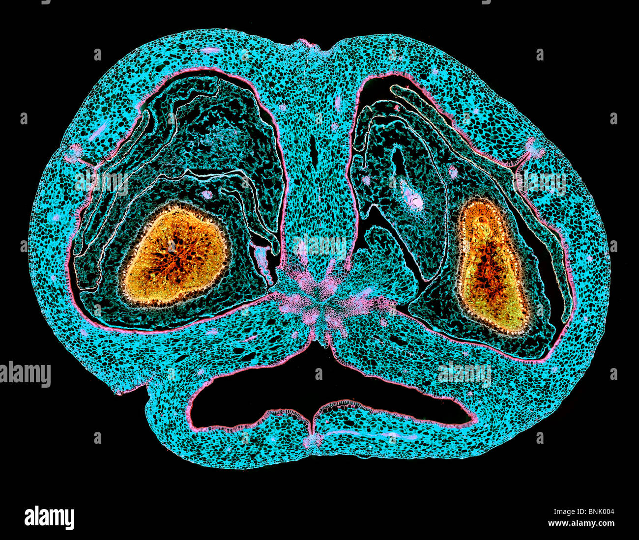 Campo oscuro fotomicrografia Hosta piantaggine lily TS pod di sementi Foto Stock