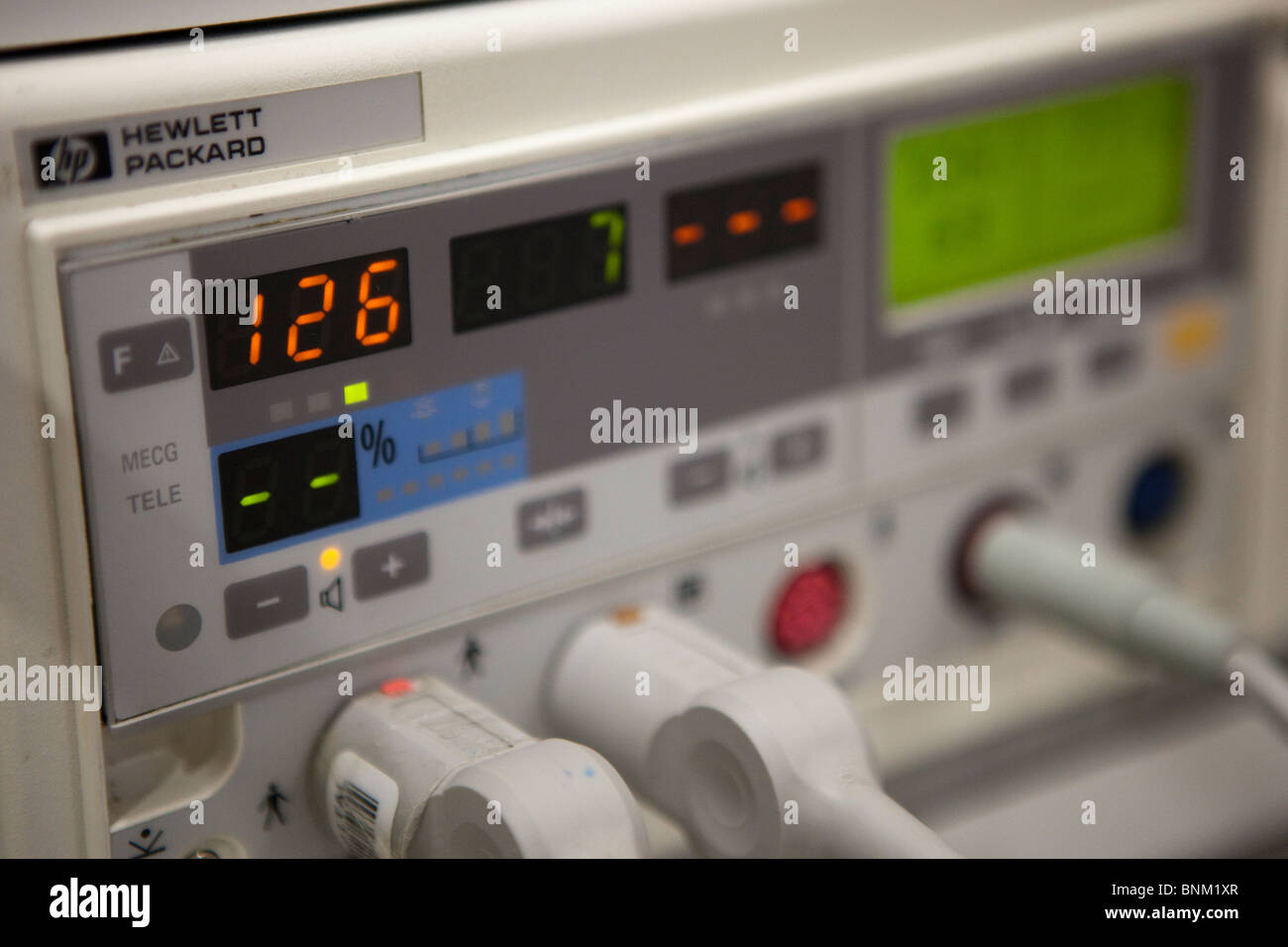 Monitor frequenza cardiaca utilizzato durante il parto Foto Stock