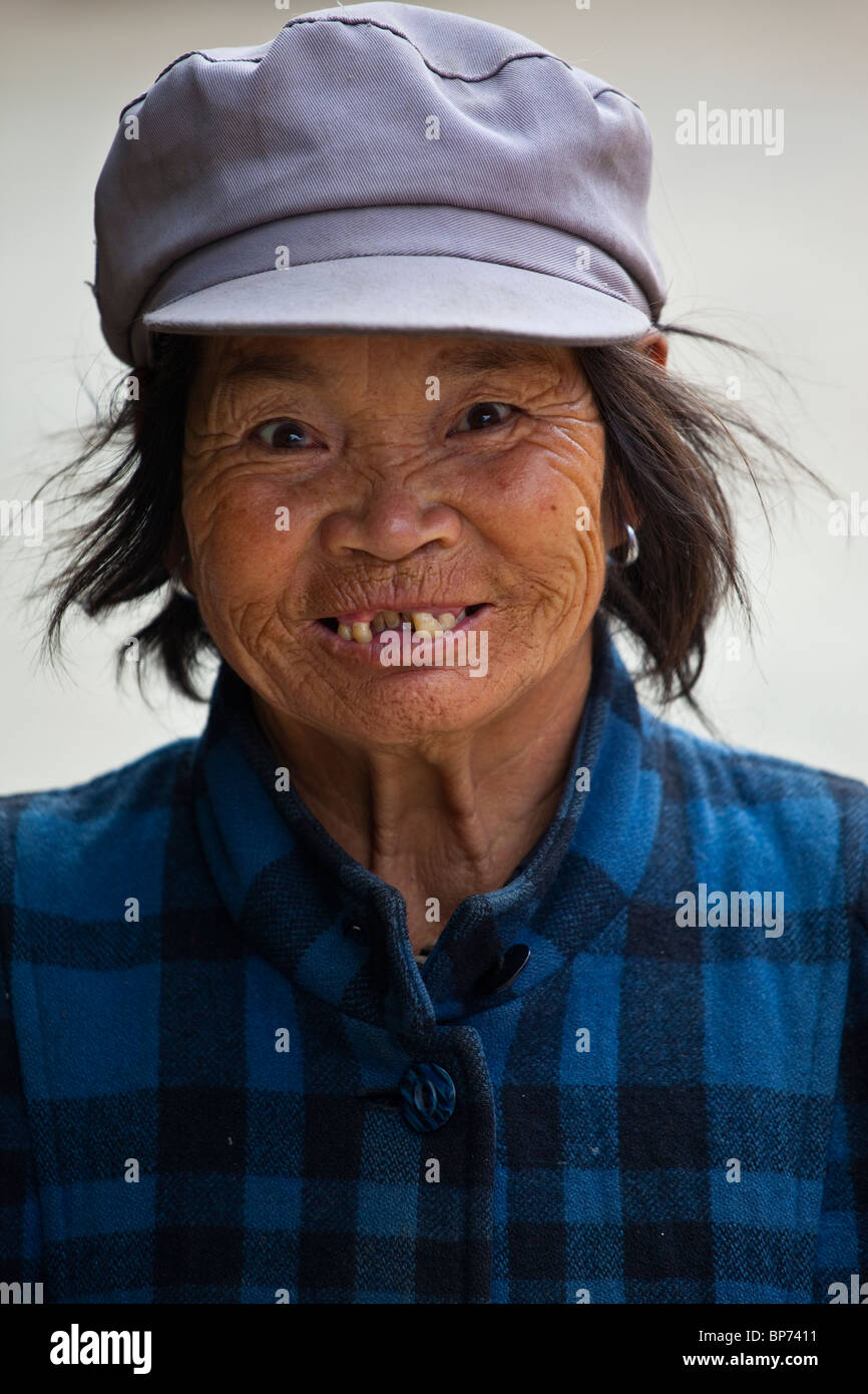 Disabili mentali donna nel villaggio Shaxi, nella provincia dello Yunnan in Cina Foto Stock