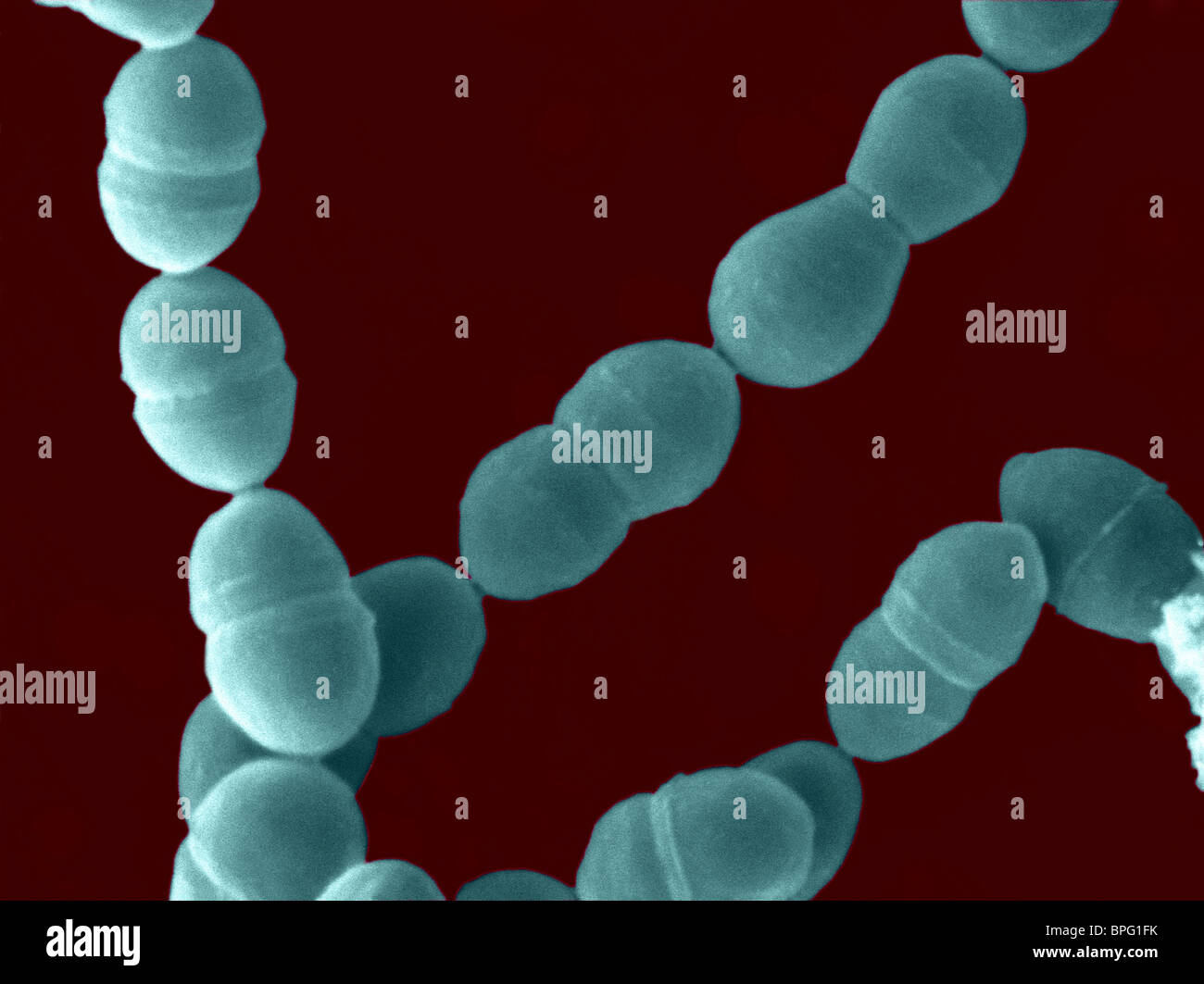 Questo è un falso color scanning electron microfotografia di Streptococcus thermophilus. Foto Stock