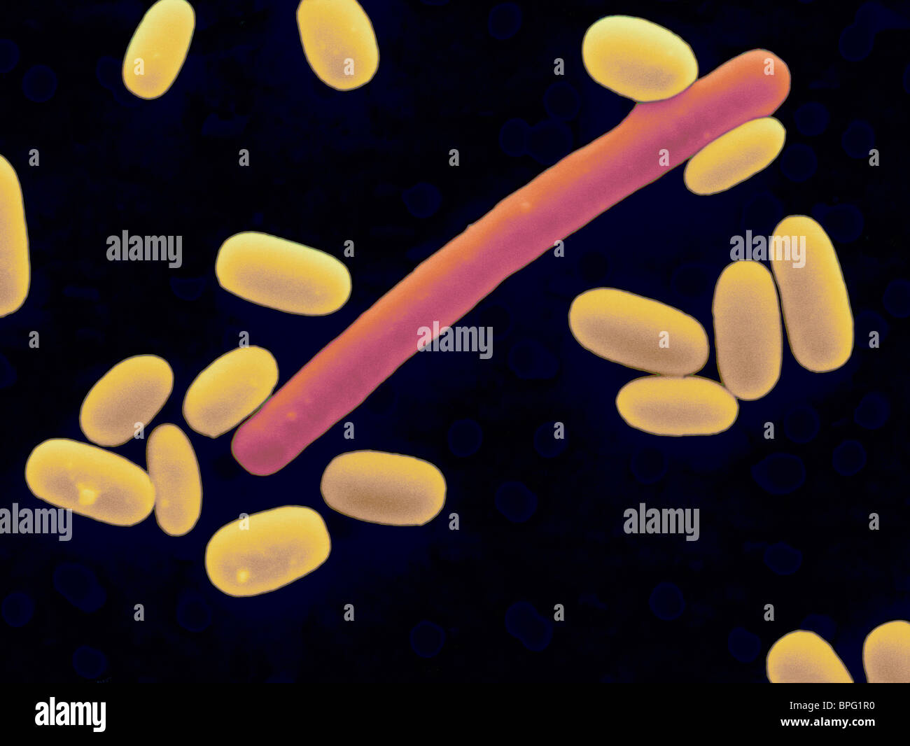 SEM di Clostridium difficile (cella lunga in rosso) circondato da purificato Clostridium difficile spore (giallo) Foto Stock