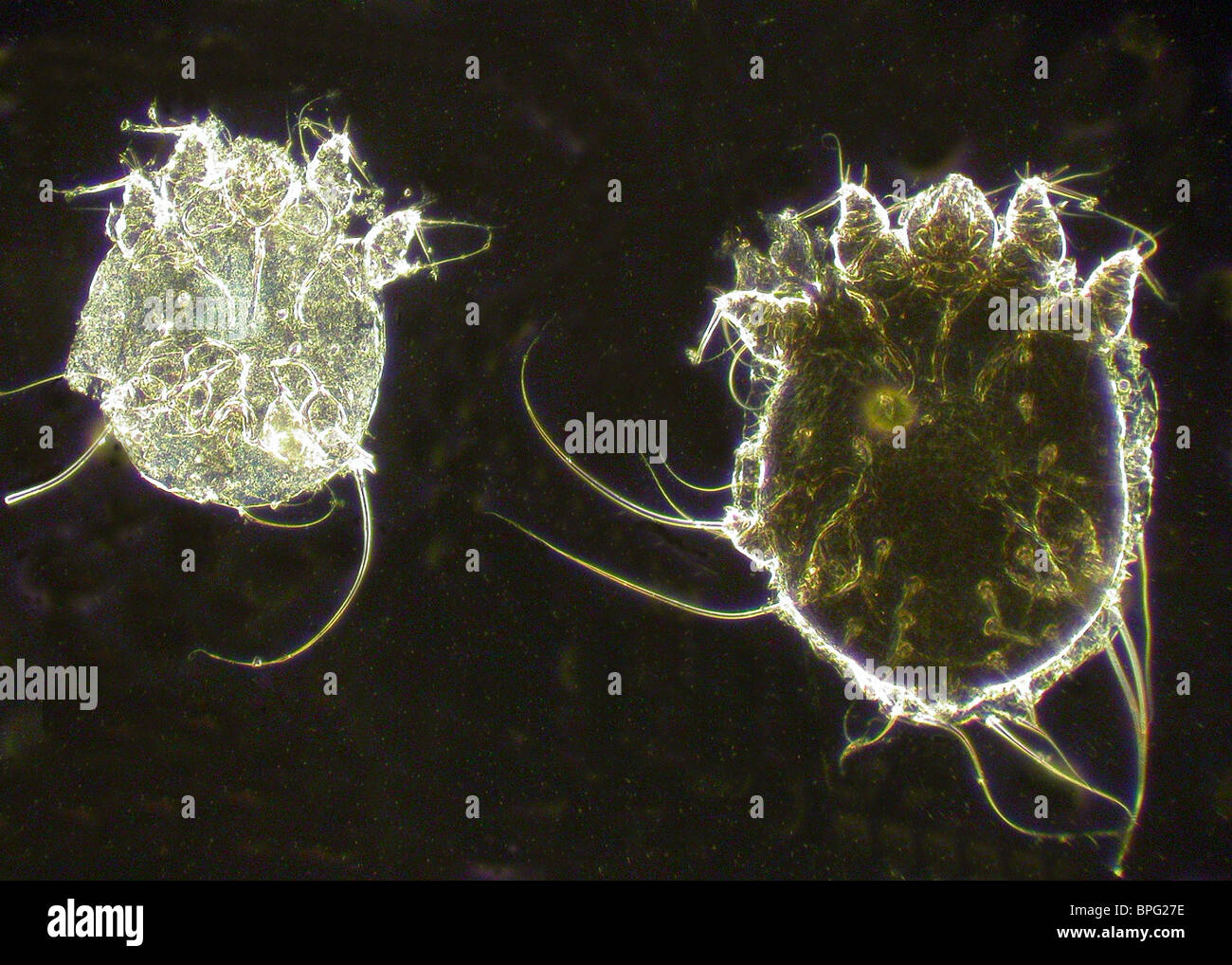 Causati dall'acaro Sarcoptes scabiei, varietà hominis, produce intenso prurito, rash cutanei. Foto Stock