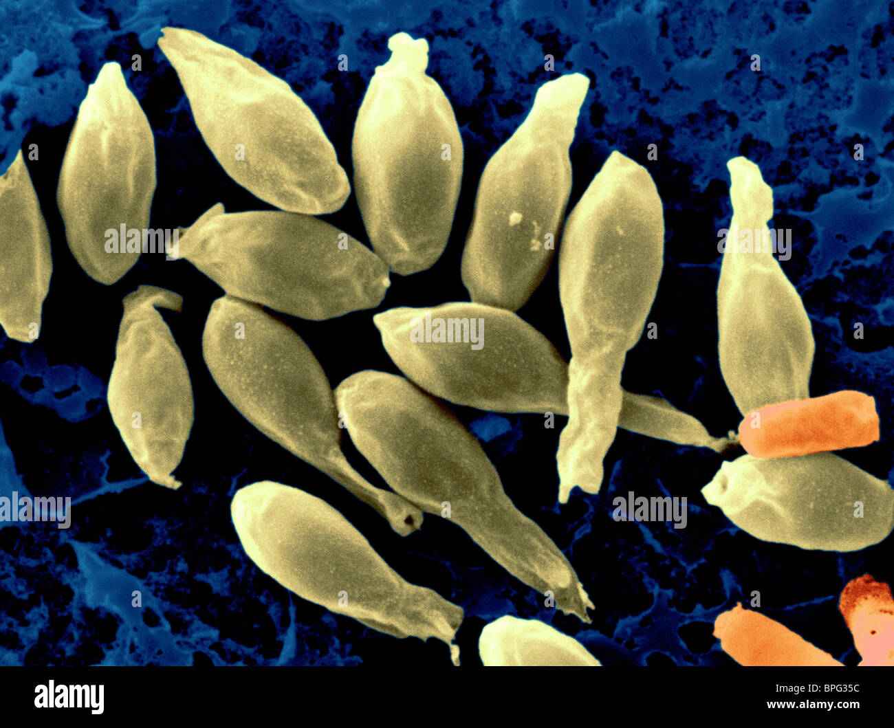 Clostridium difficile spore ancora con il loro rivestimento. Foto Stock