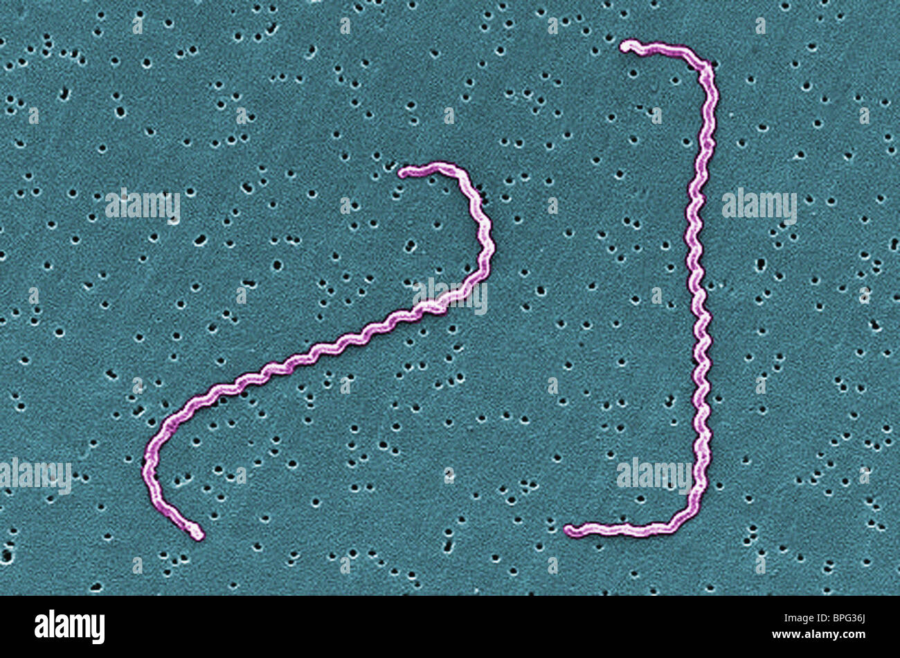 Scanning electron microfotografia (SEM) della presenza di Leptospira interrogans ceppo RGA. Foto Stock
