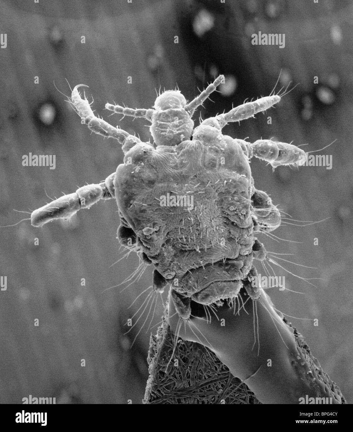 SEM - una micrografia al microscopio elettronico a scansione (SEM) di un pidocchio di granchio, Phthirus pube. Foto Stock