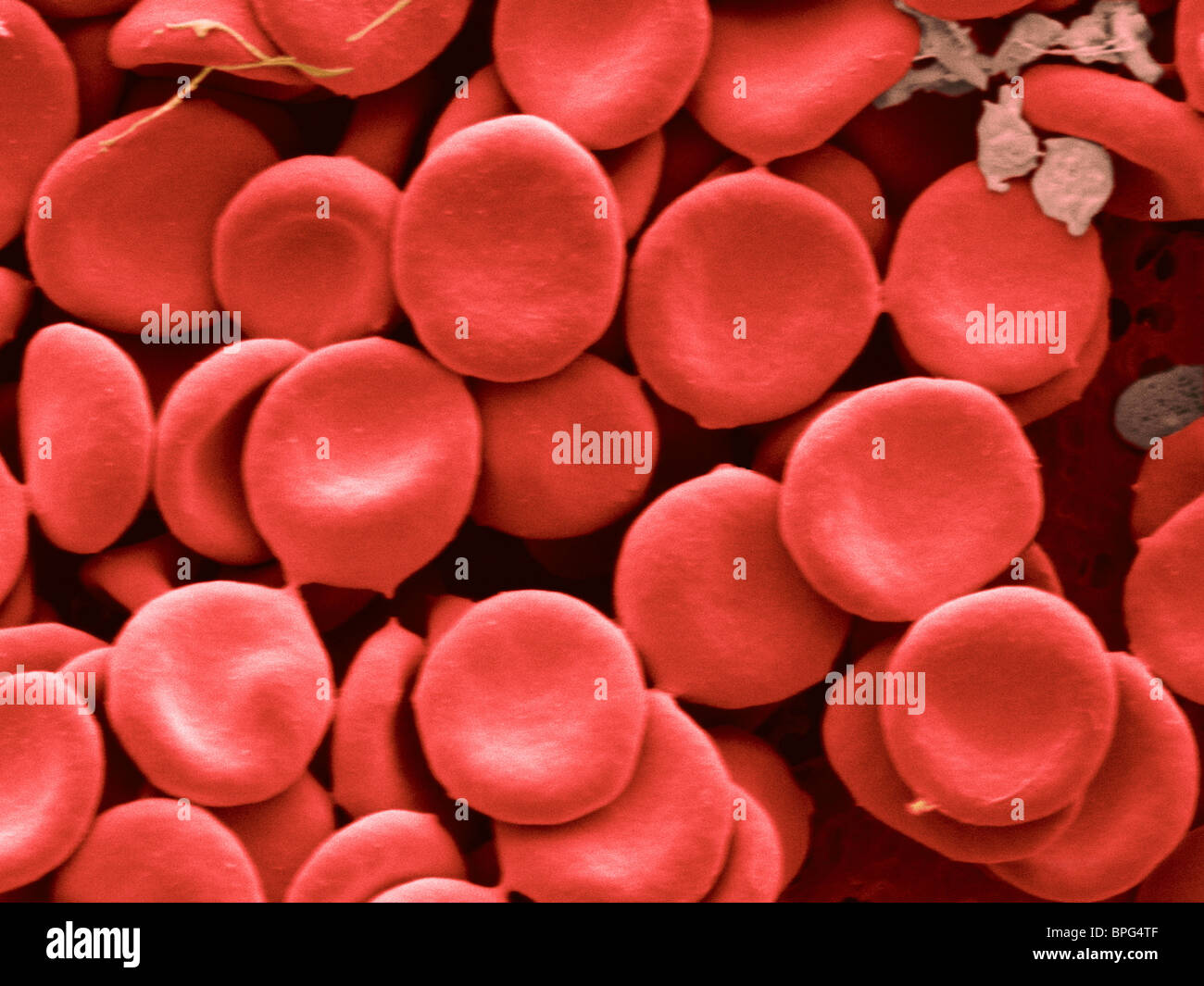 I globuli rossi umani mediante microscopia elettronica a scansione (SEM). Foto Stock