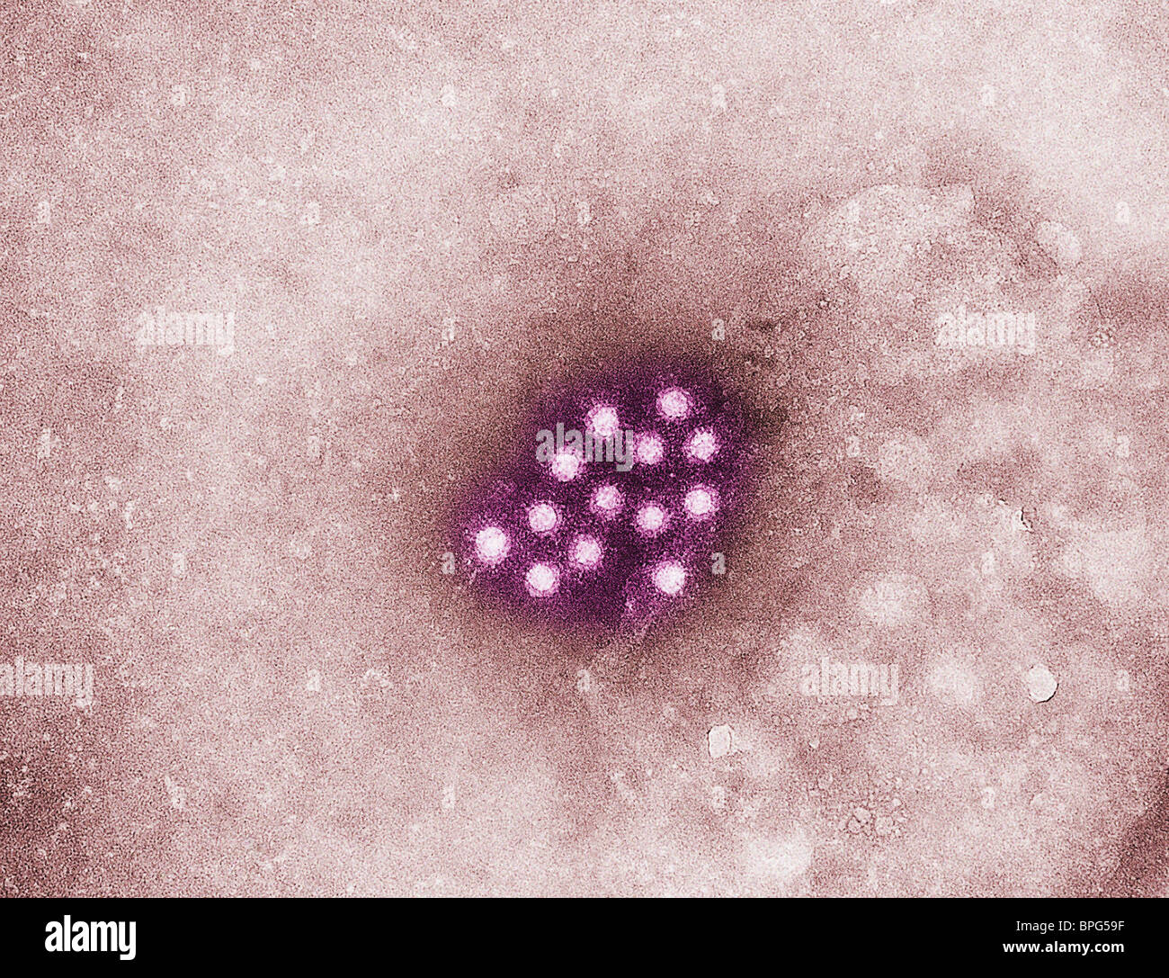 Un micrografico elettronico del virus di epatite A (HAV), un virus di RNA che può sopravvivere per un mese a temperatura ambiente. Foto Stock