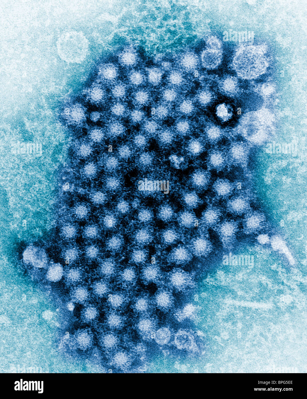 Una micrografia elettronica a trasmissione (TEM) che mostra numerosi virioni di epatite, di un ceppo sconosciuto. Foto Stock