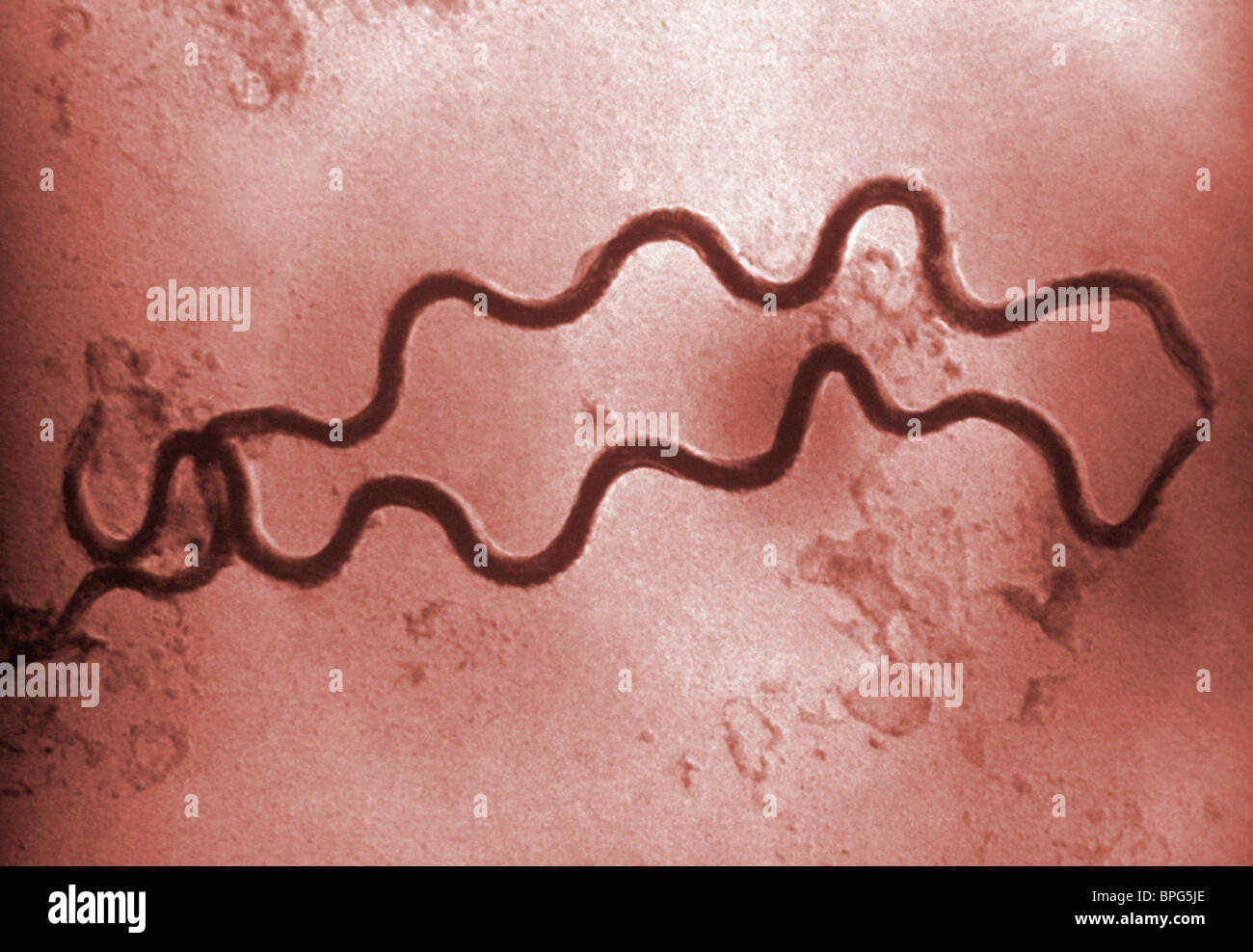 Una micrografia elettronica a trasmissione di due a forma di spirale Treponema pallidum batteri, l'agente causativo della sifilide. Foto Stock